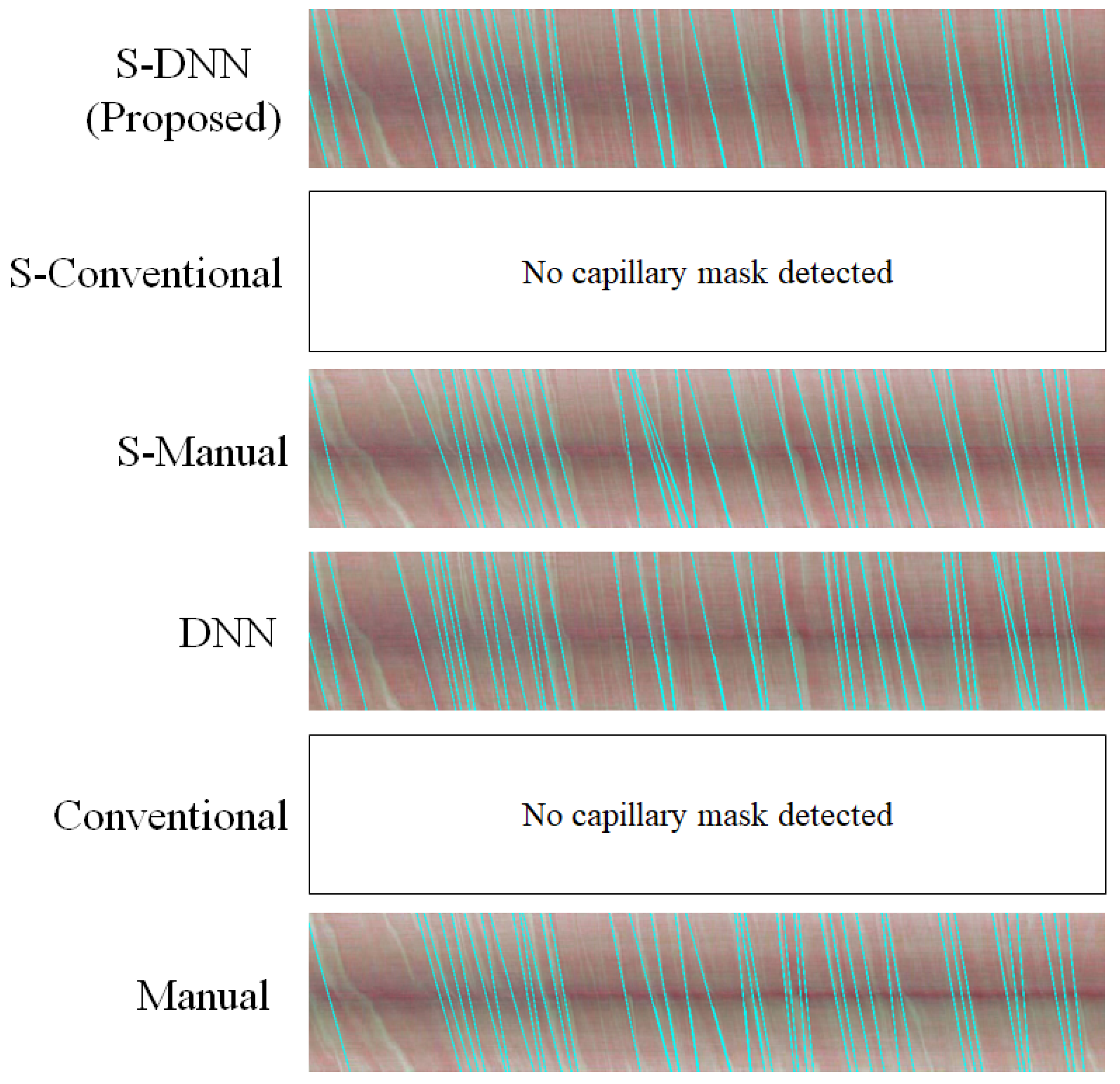 Sensors 20 07101 g0a5