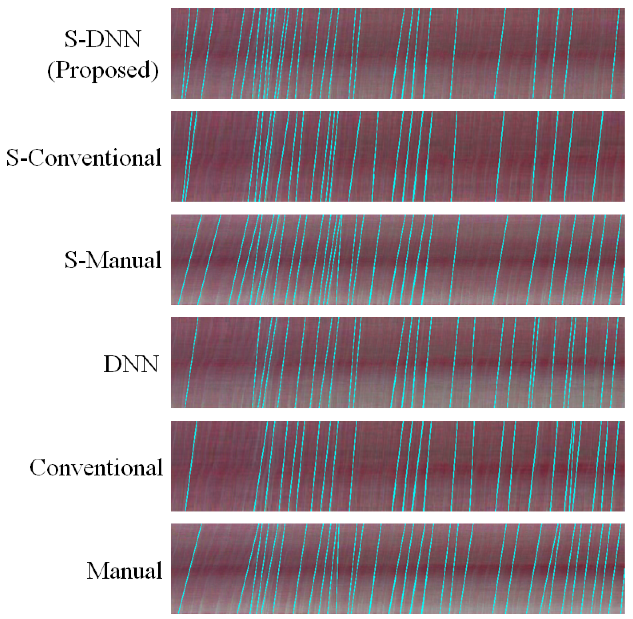 Sensors 20 07101 g0a6