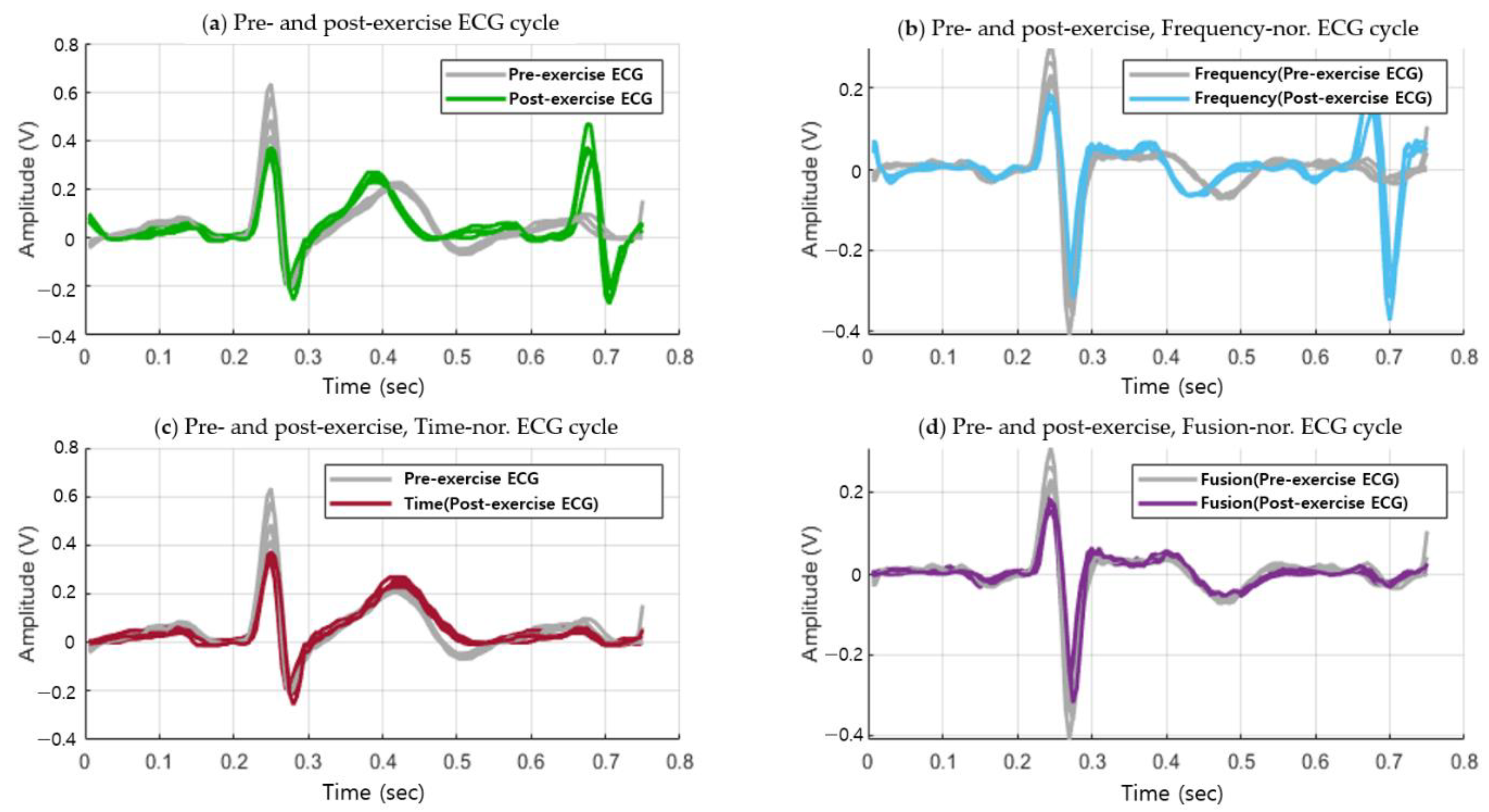 Sensors Free Full Text Recognition System Using Fusion Normalization Based On Morphological Features Of Post Exercise Ecg For Intelligent Biometrics