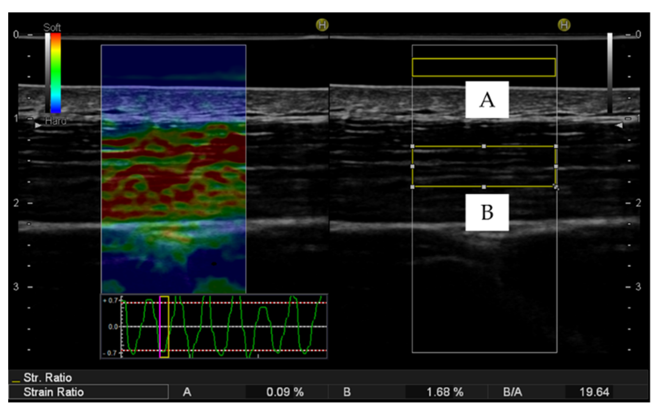 Sensors 20 07200 g002 Sensors 20 07200 g002