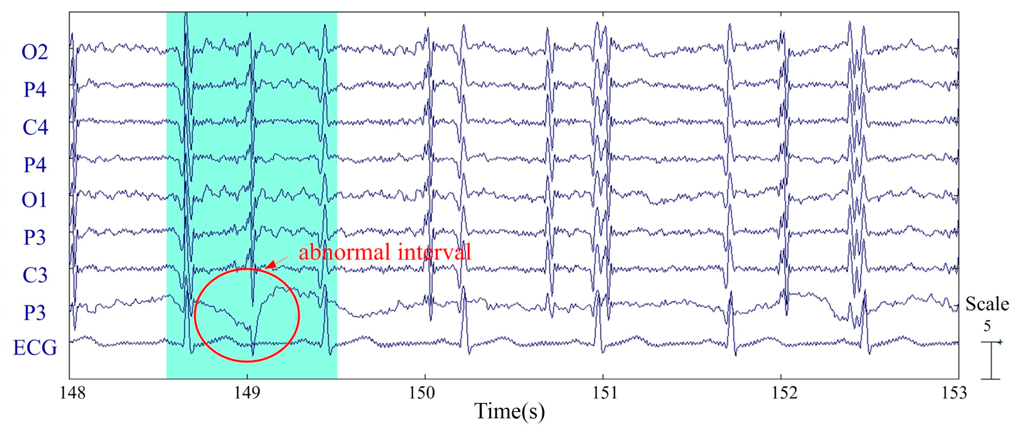 Sensors 20 07250 g006