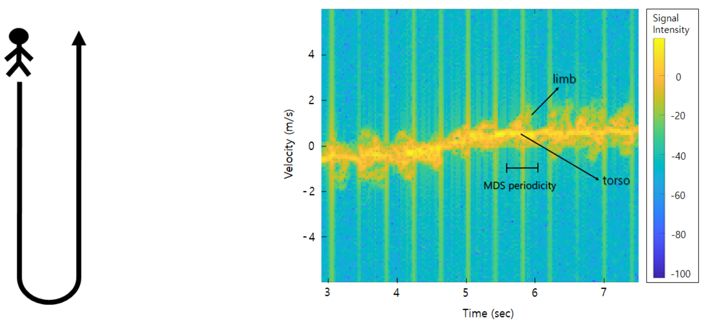 Sensors Free FullText RadarSpectrogramBased UAV Classification Using Convolutional Neural