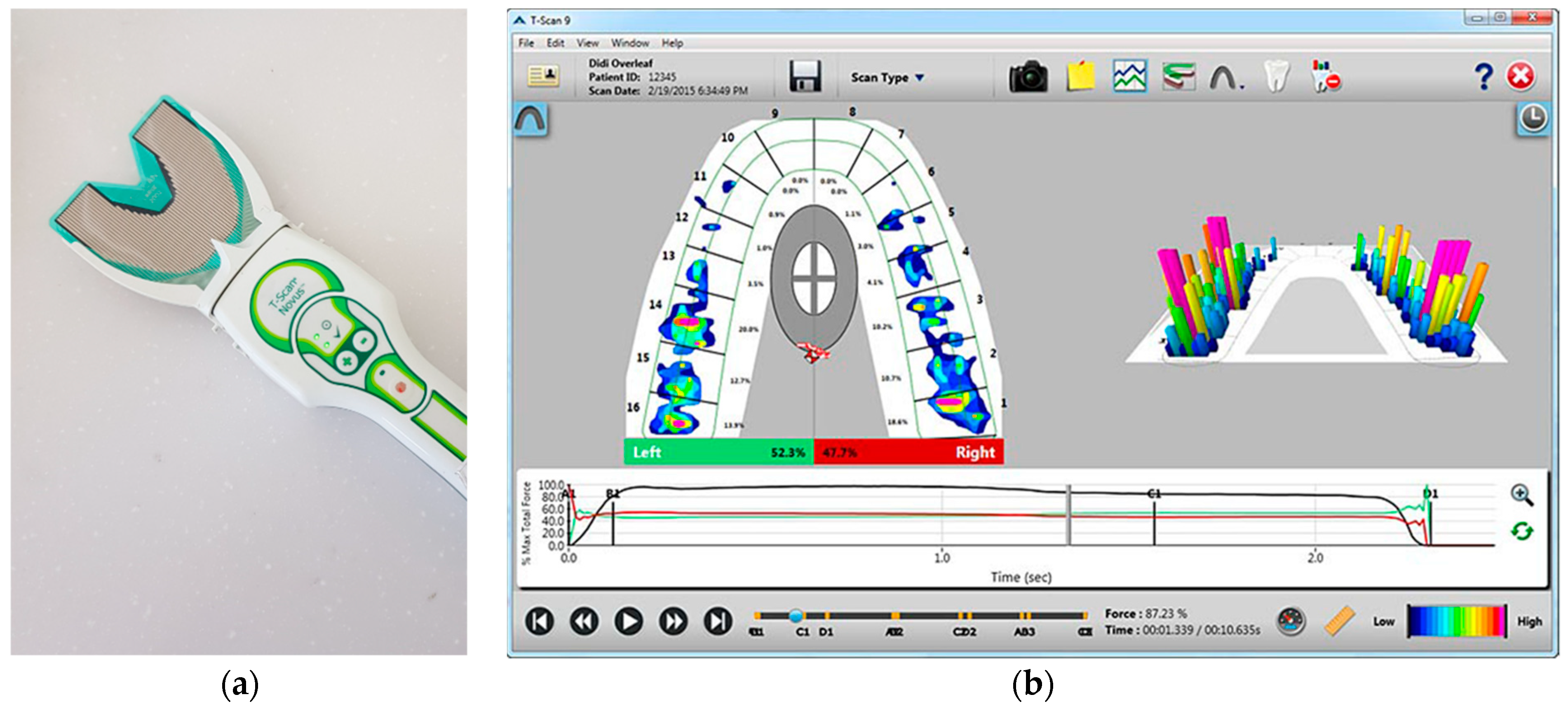 Sensors 21 00541 g002 Sensors 21 00541 g002
