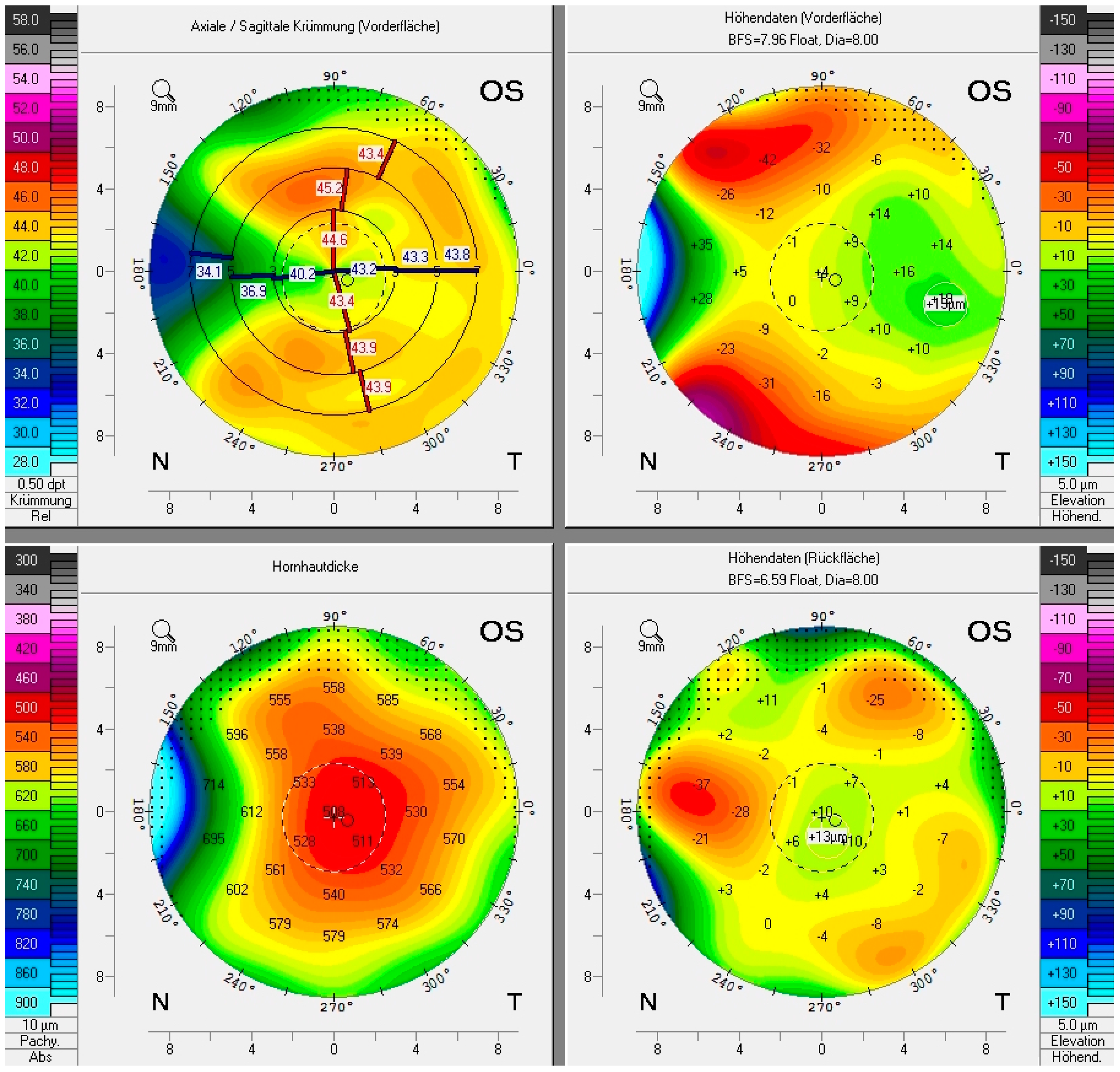 Sensors 21 00975 g007