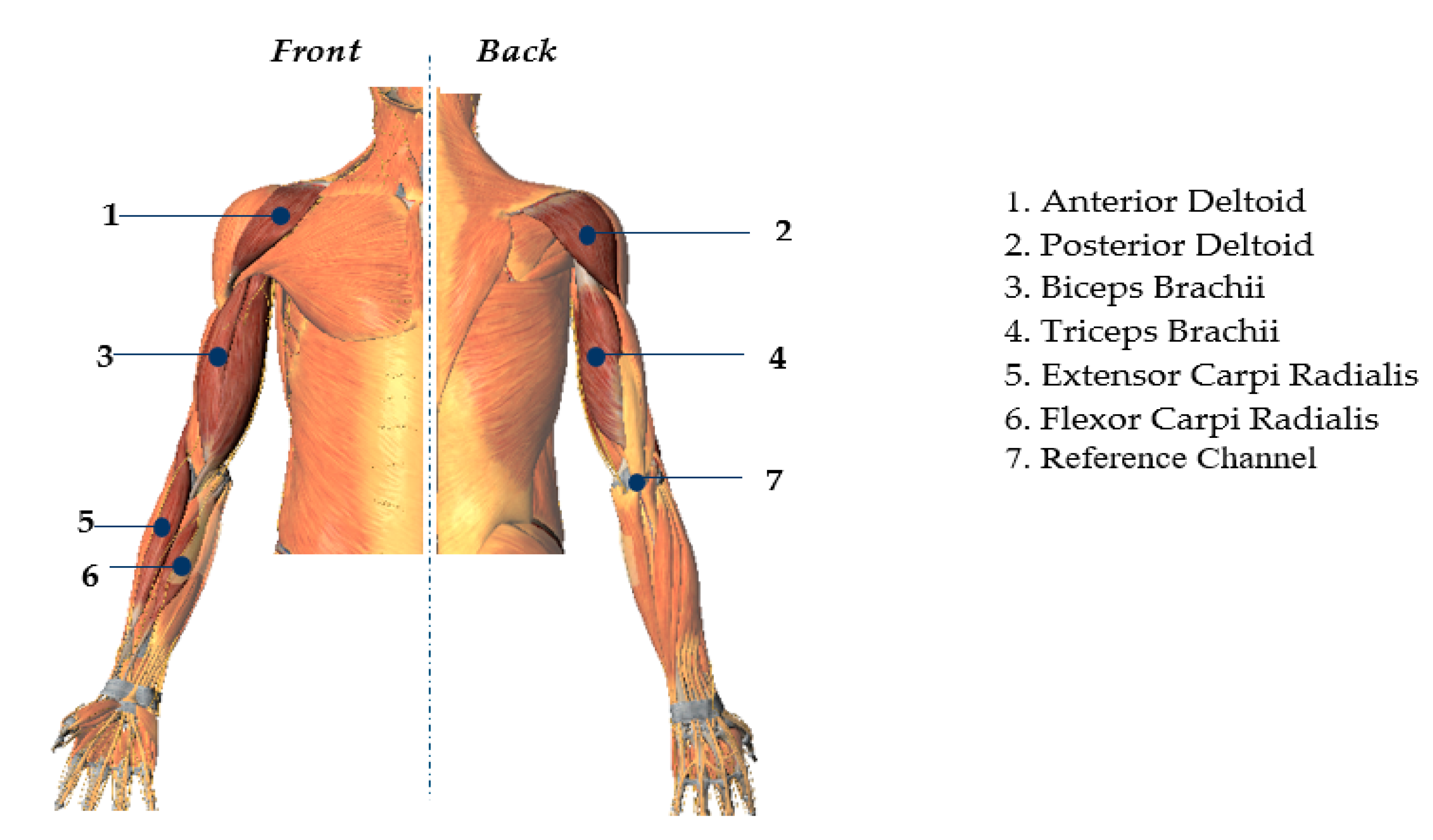 Electromyographic evaluation of upper limb muscles involved in armwrestling  sport simulation during dynamic and static conditions - ScienceDirect