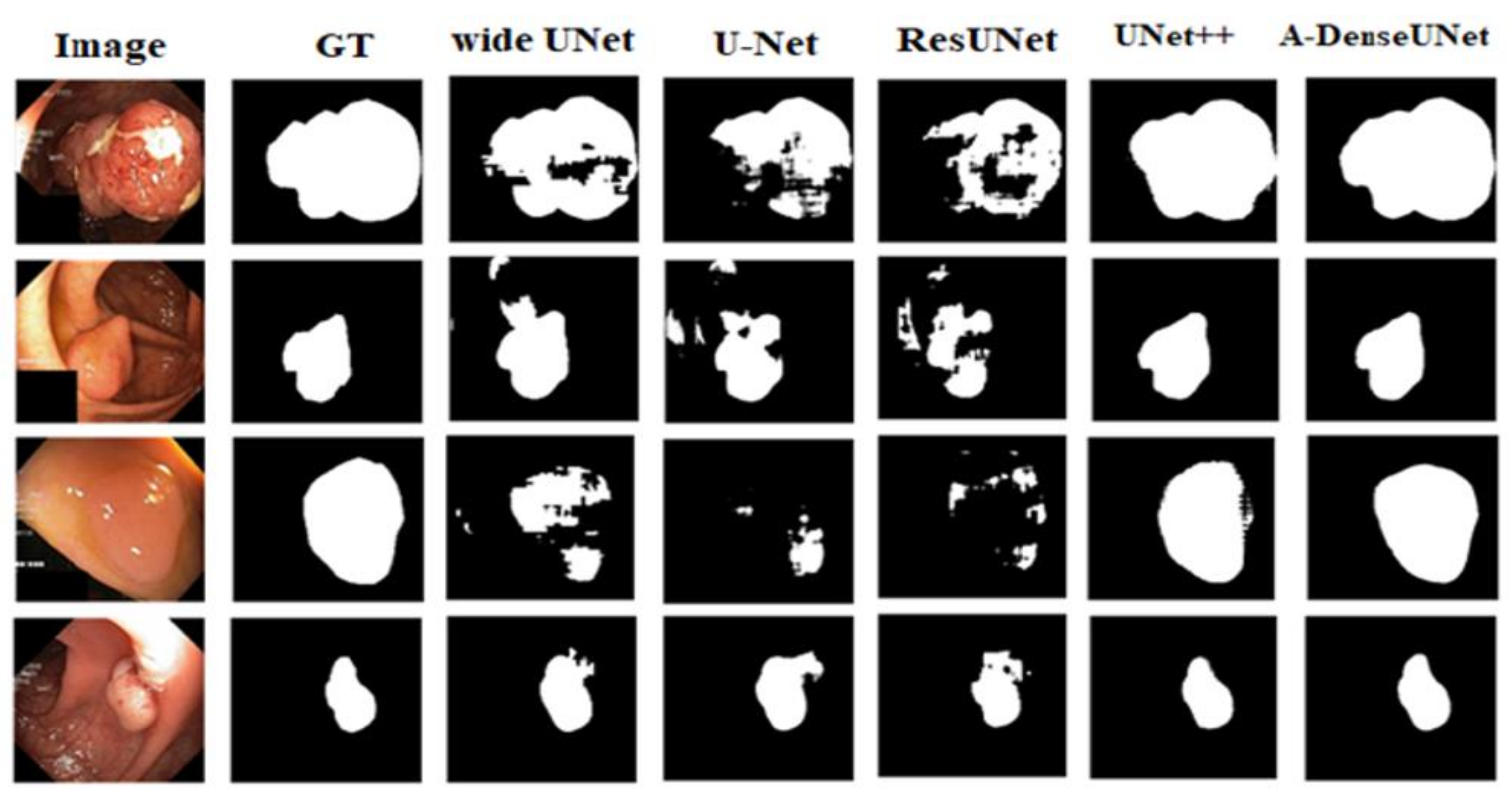 Sensors Free Full Text A Denseunet Adaptive Densely Connected Unet For Polyp Segmentation In Colonoscopy Images With Atrous Convolution Html Sensors Free Full Text A Denseunet Adaptive Densely Connected Unet For Polyp Segmentation In Colonoscopy Images With Atrous Convolution Html