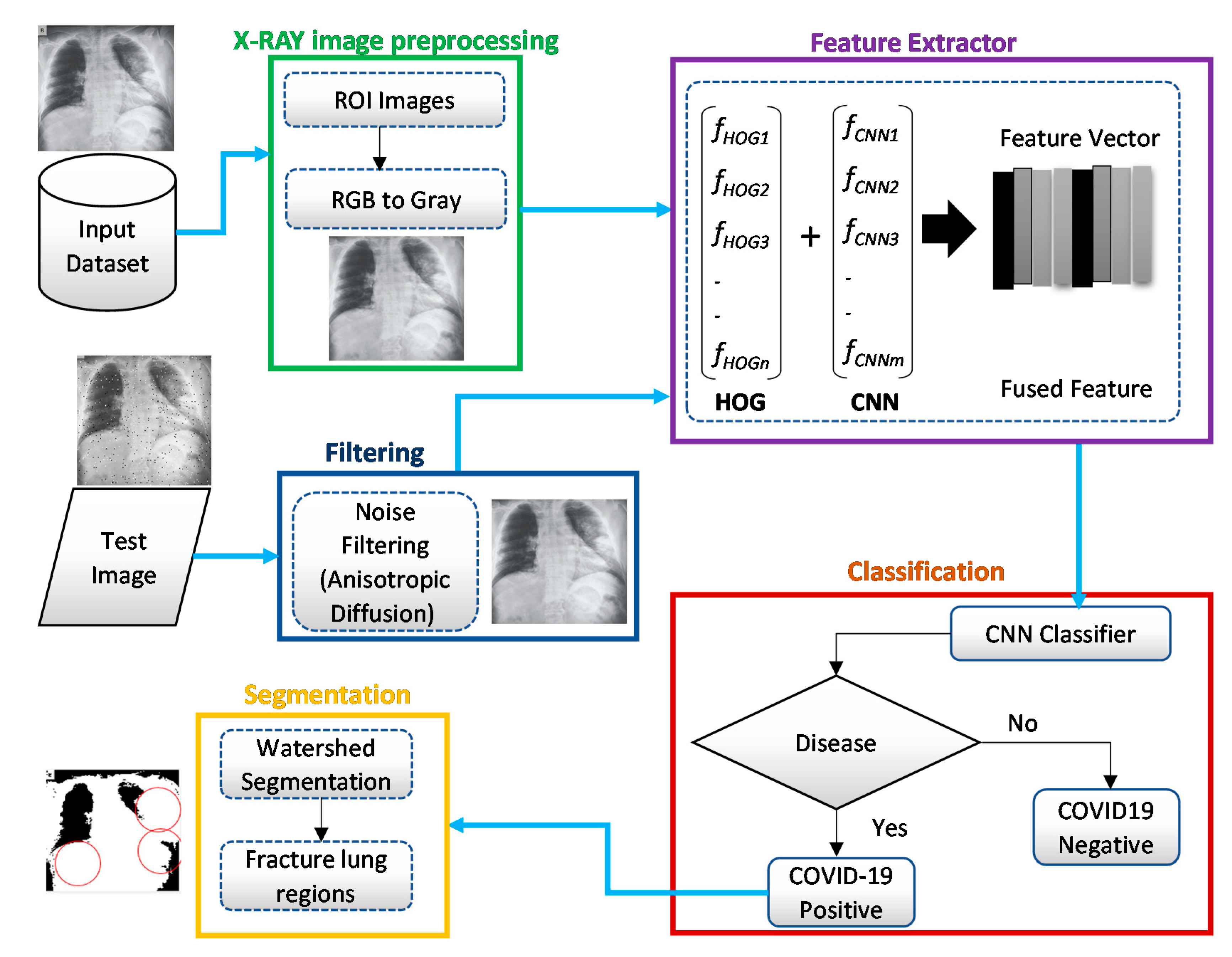 Sensors | Free Full-Text | COVID-19 Detection from Chest X-ray Images ...