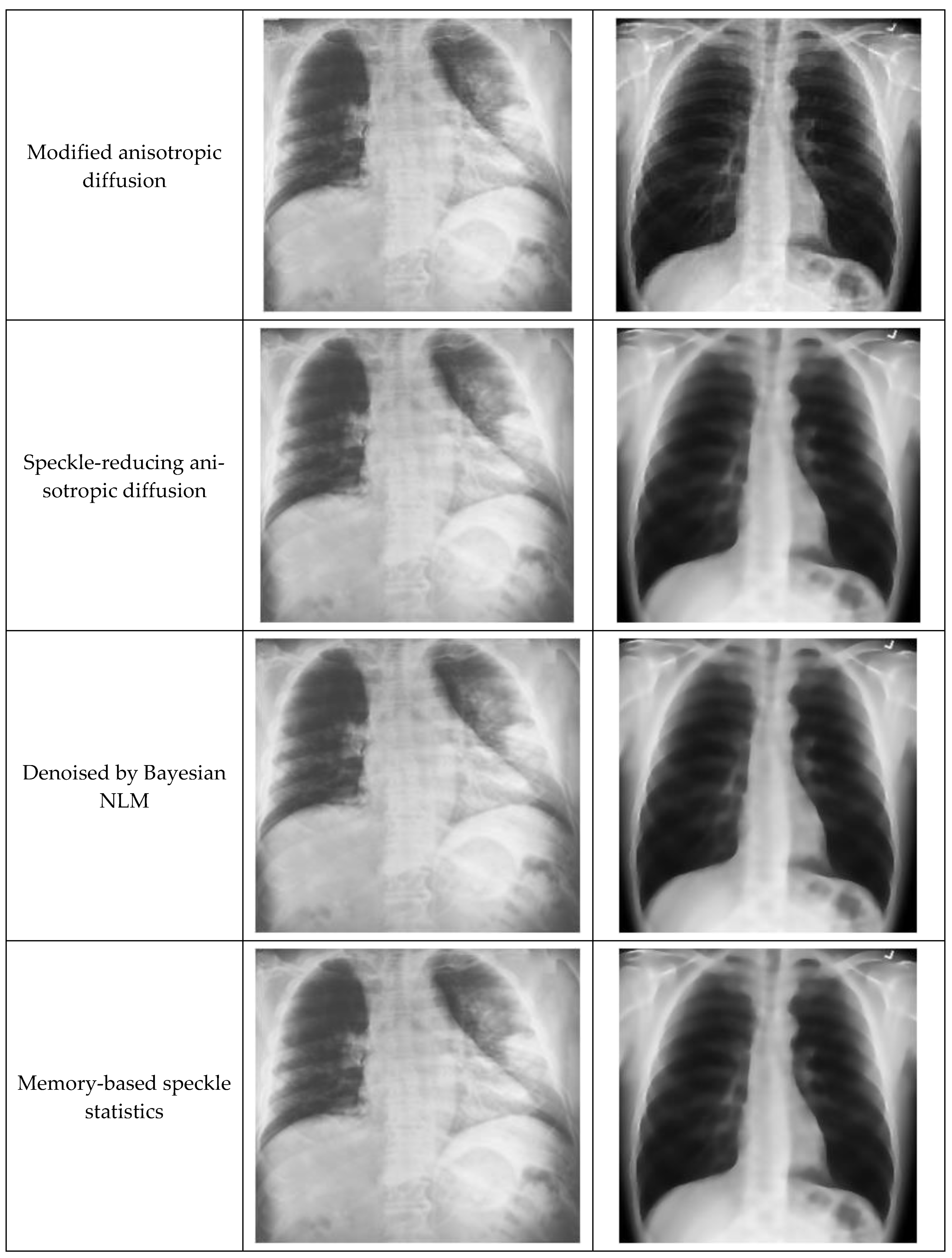Sensors 21 01480 g005b