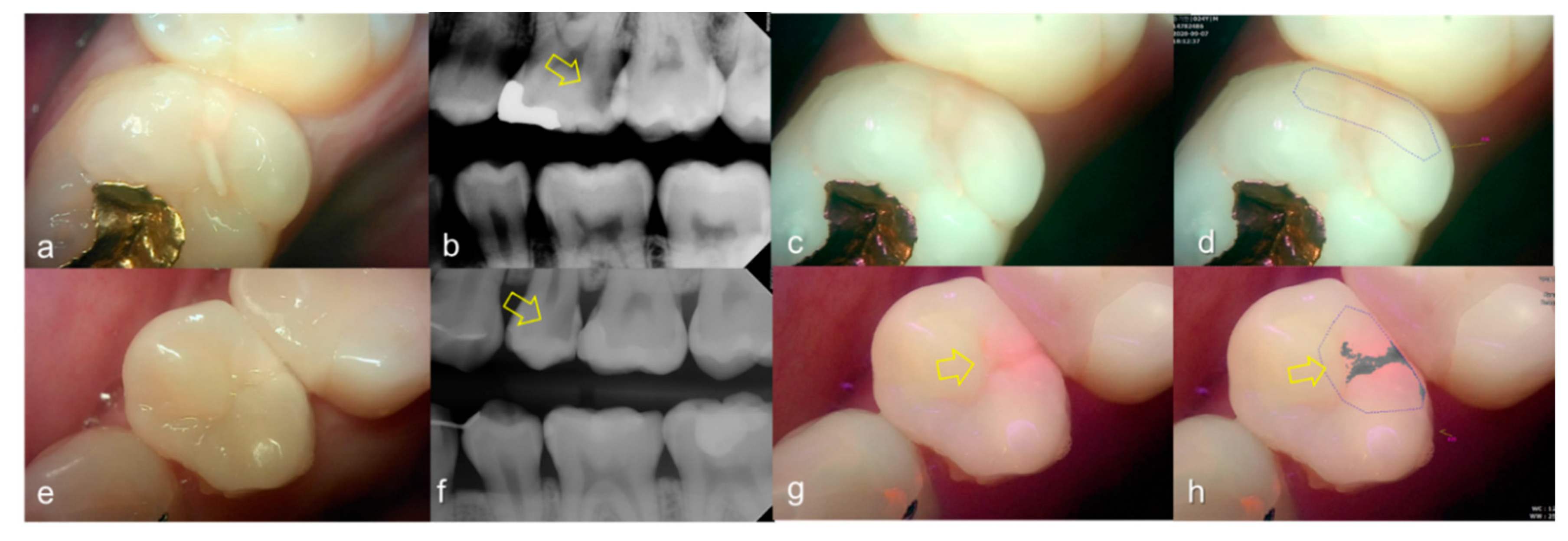 Sensors 21 01741 g008