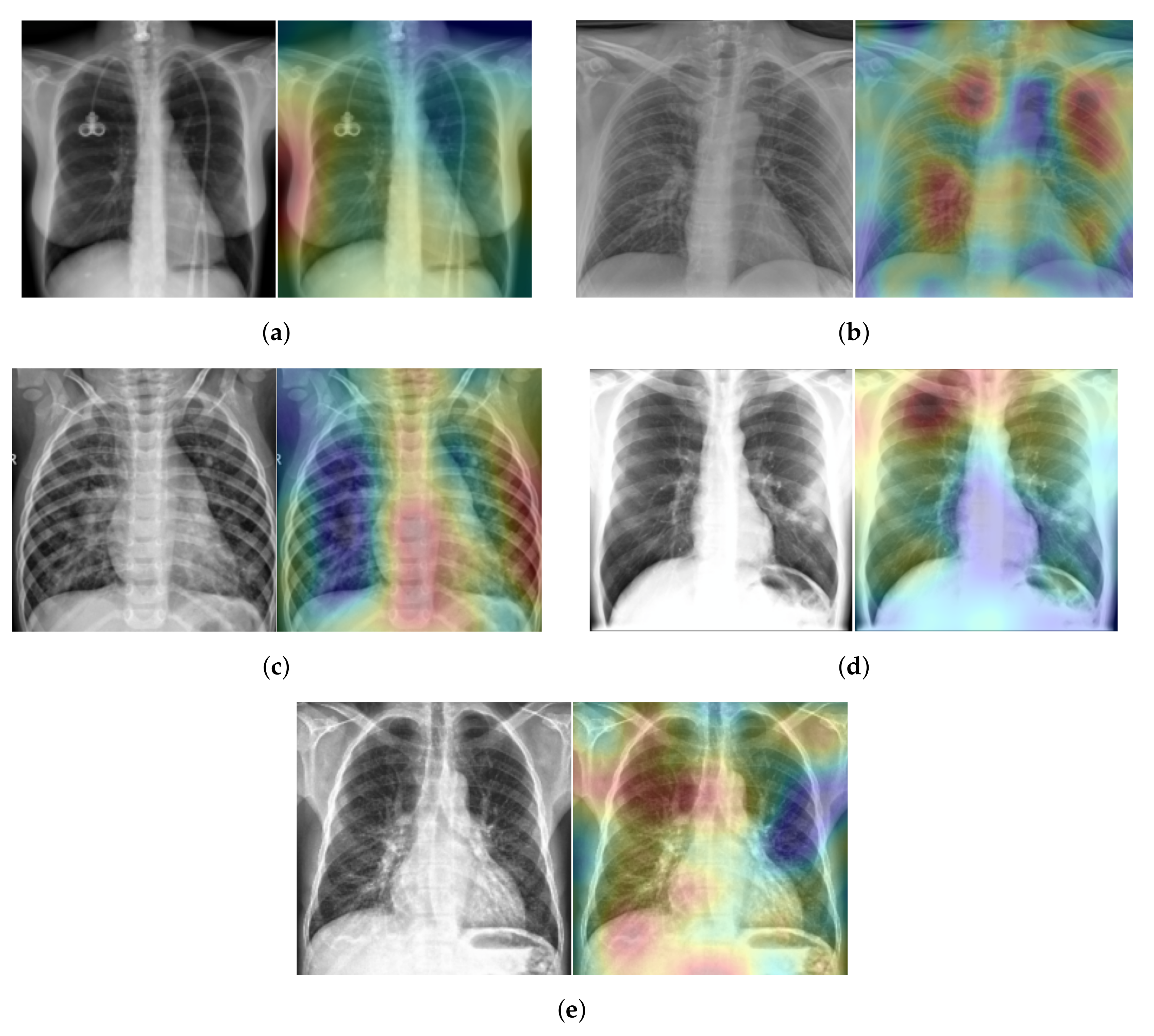Sensors 21 01742 g011