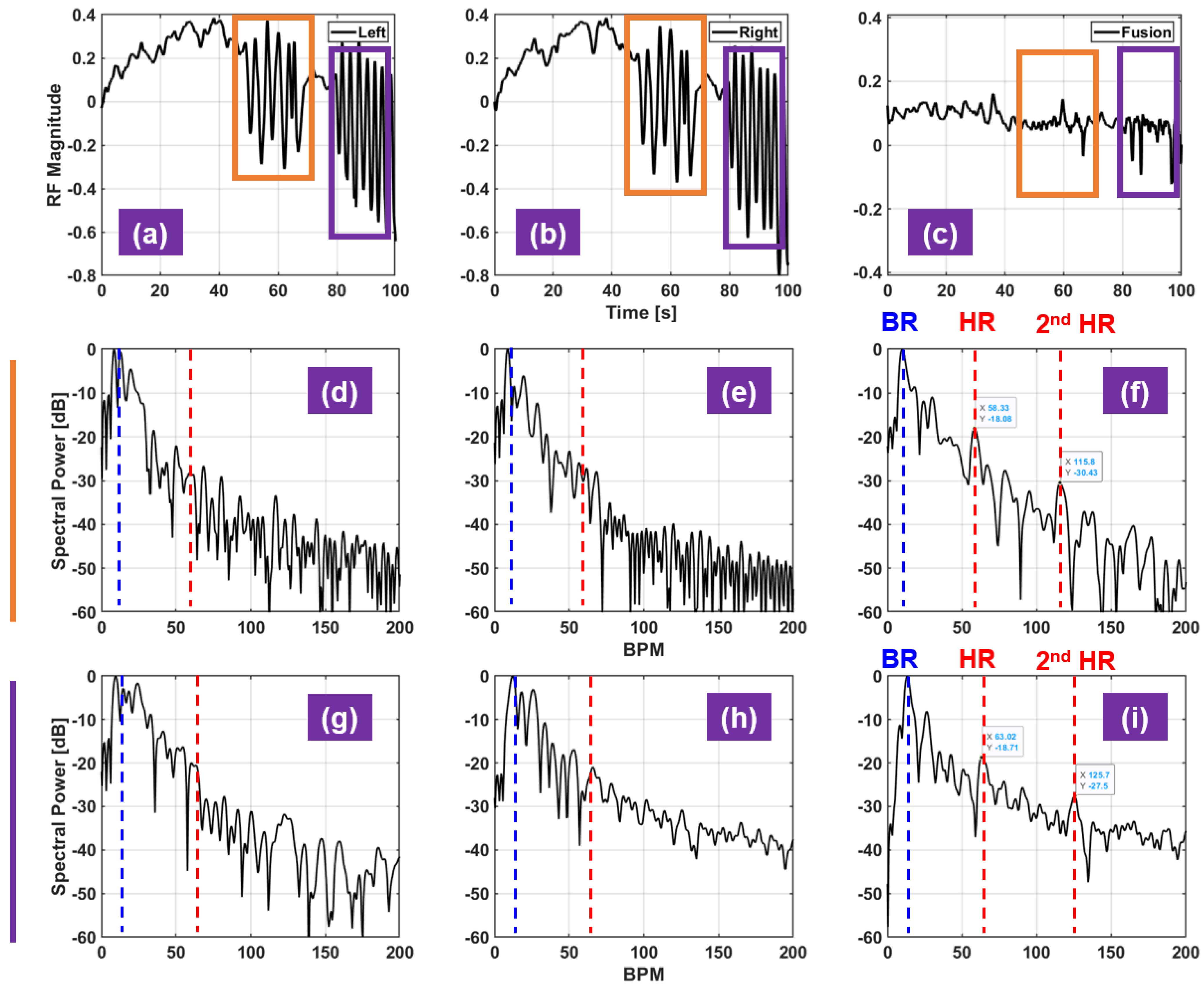 Sensors 21 01774 g005 Sensors 21 01774 g005
