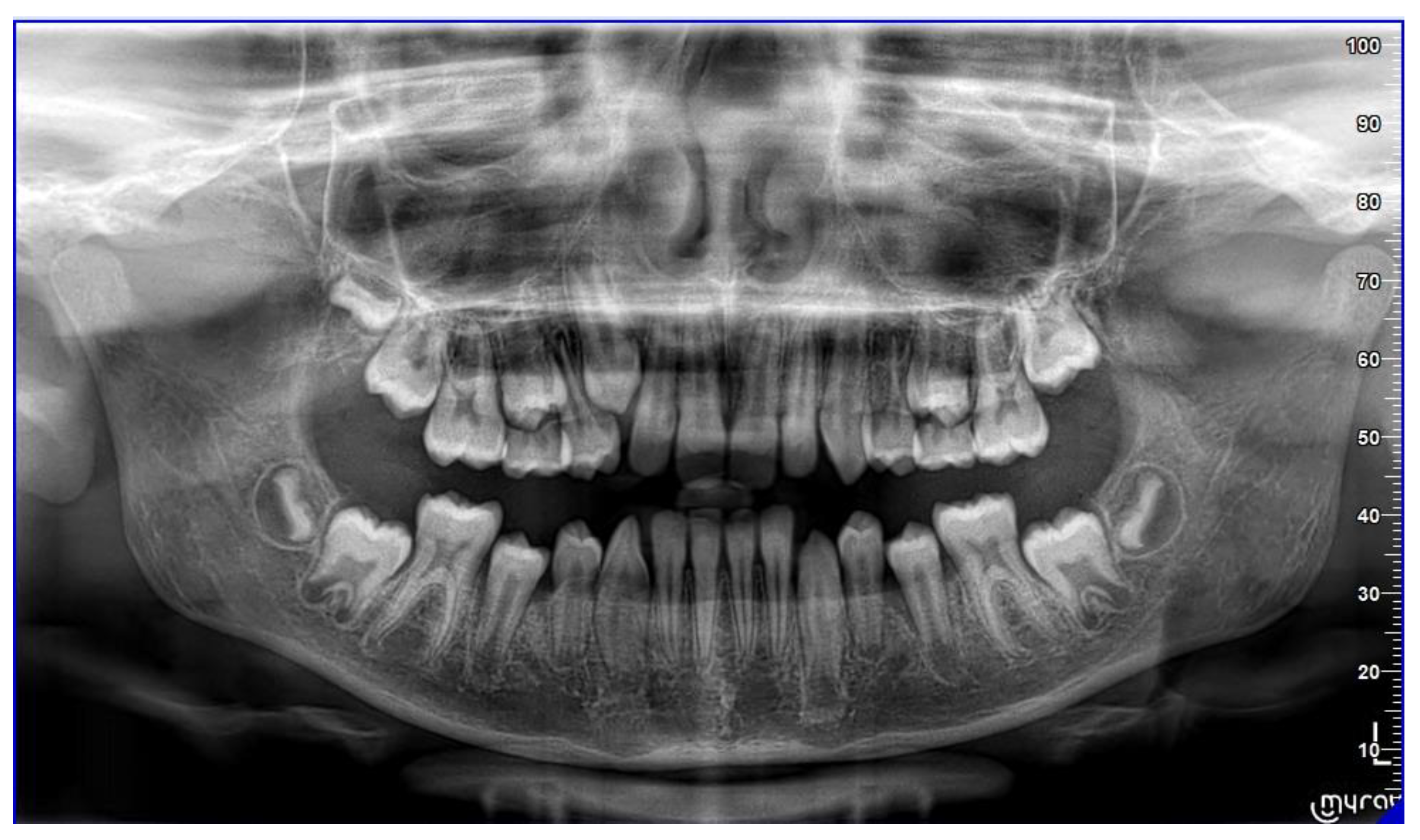 Sensors 21 01856 g007