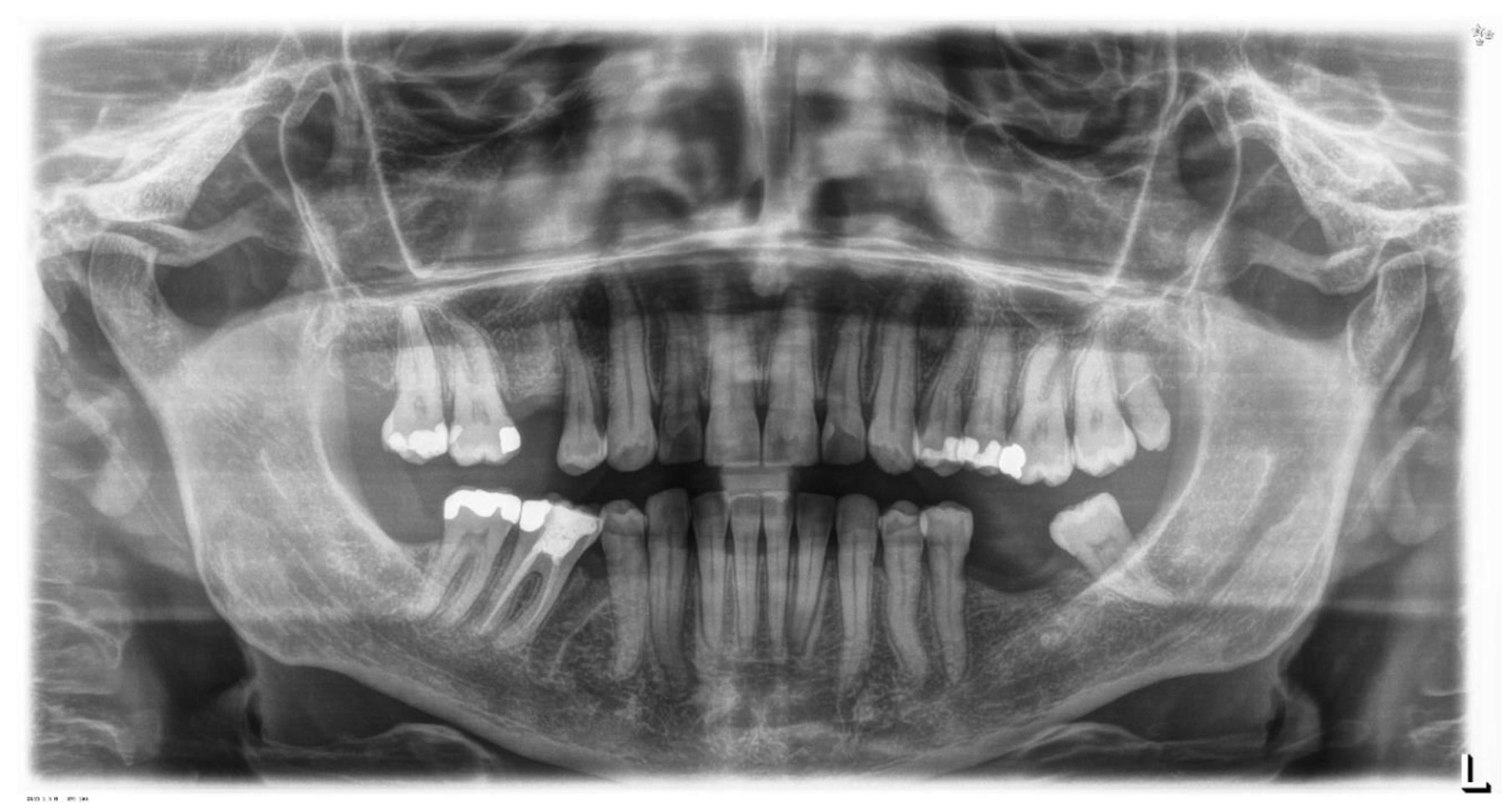 Sensors 21 01856 g009