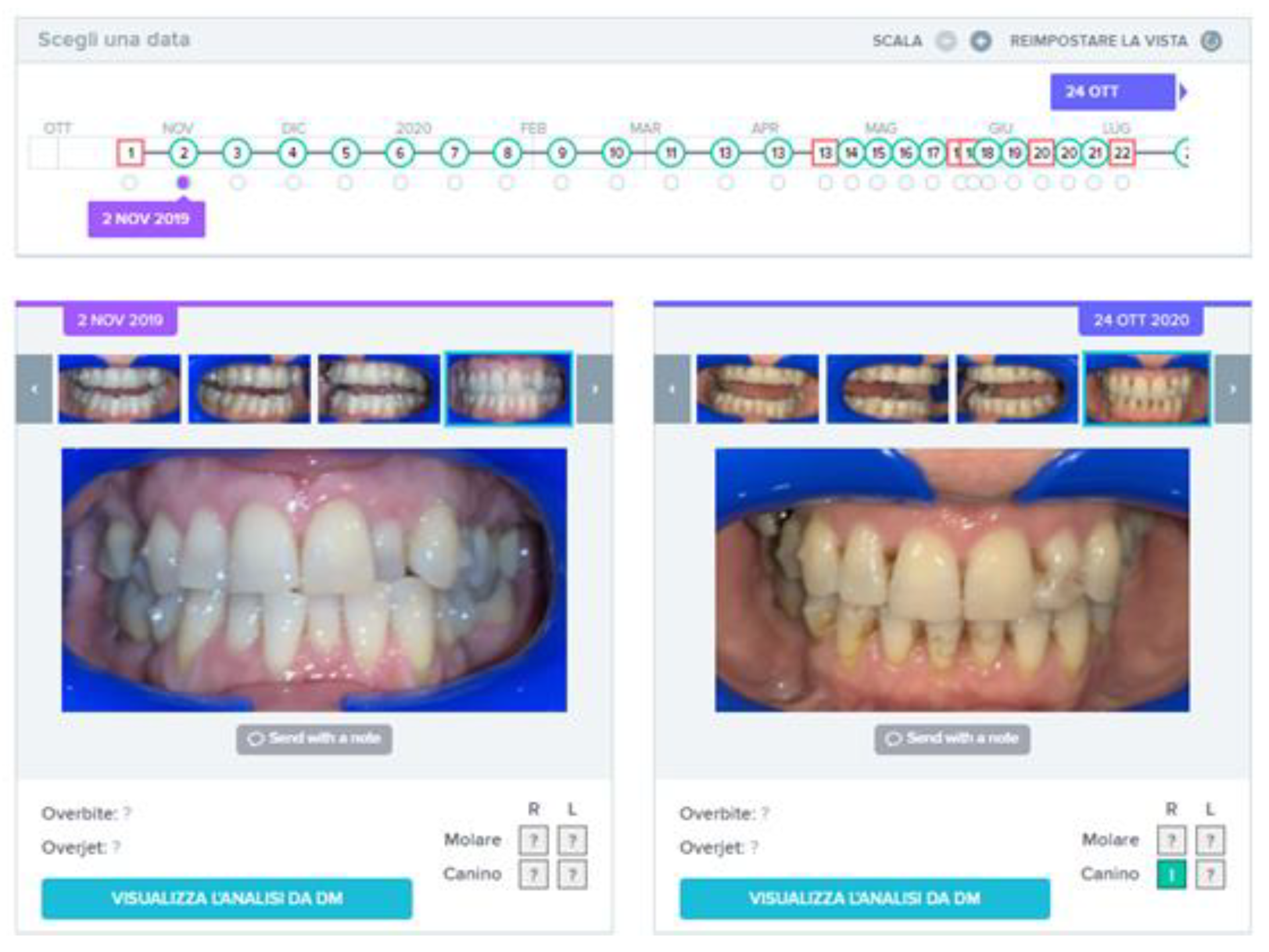 Sensors 21 01856 g011