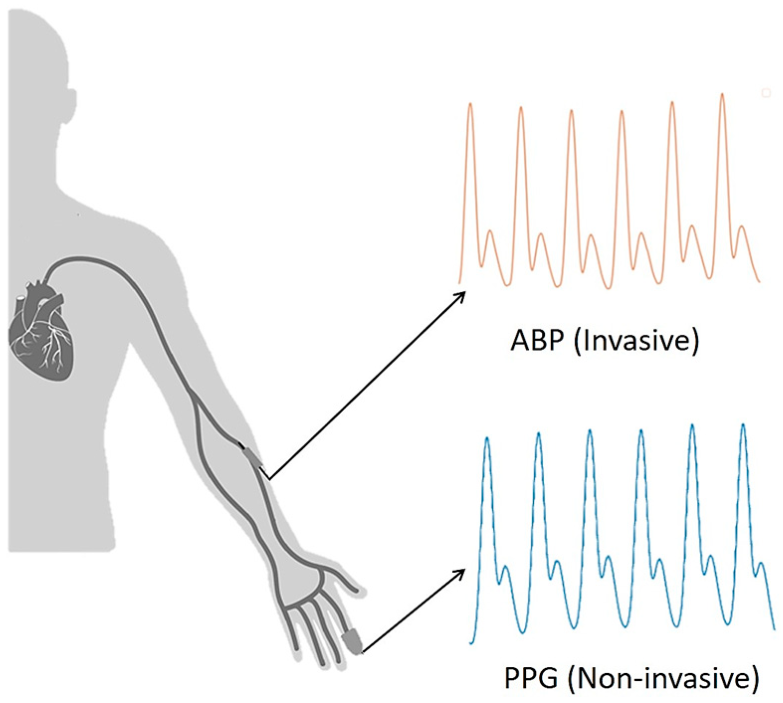 Sensors Free Full Text An Estimation Method of Continuous Non