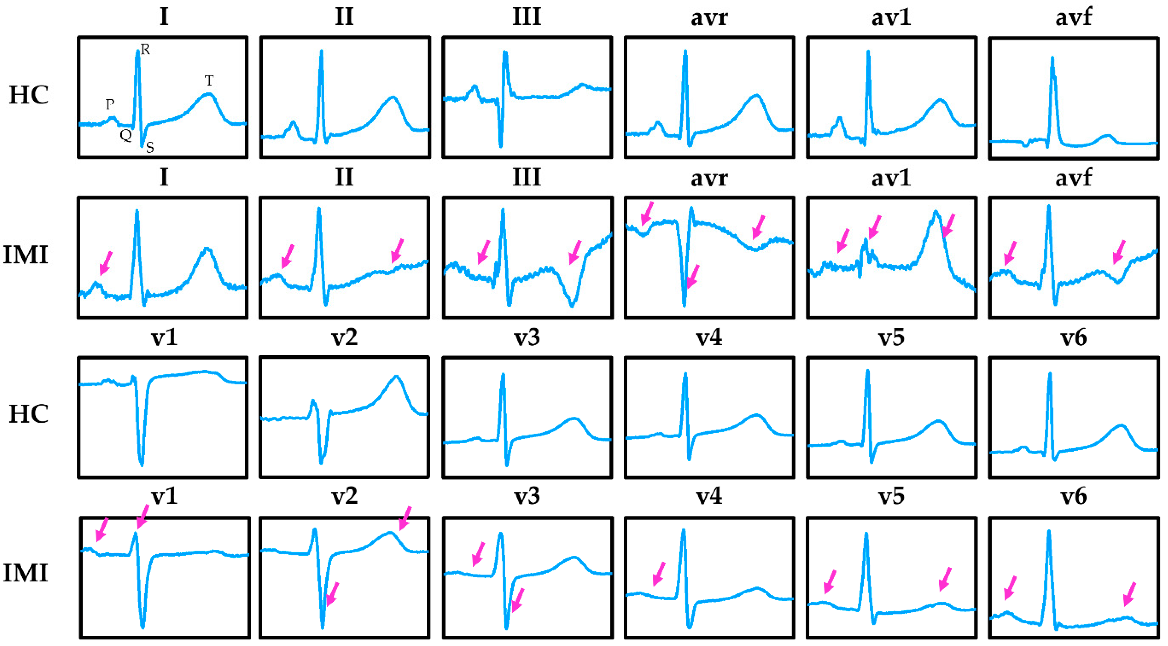 Sensors 21 01906 g004 Sensors 21 01906 g004