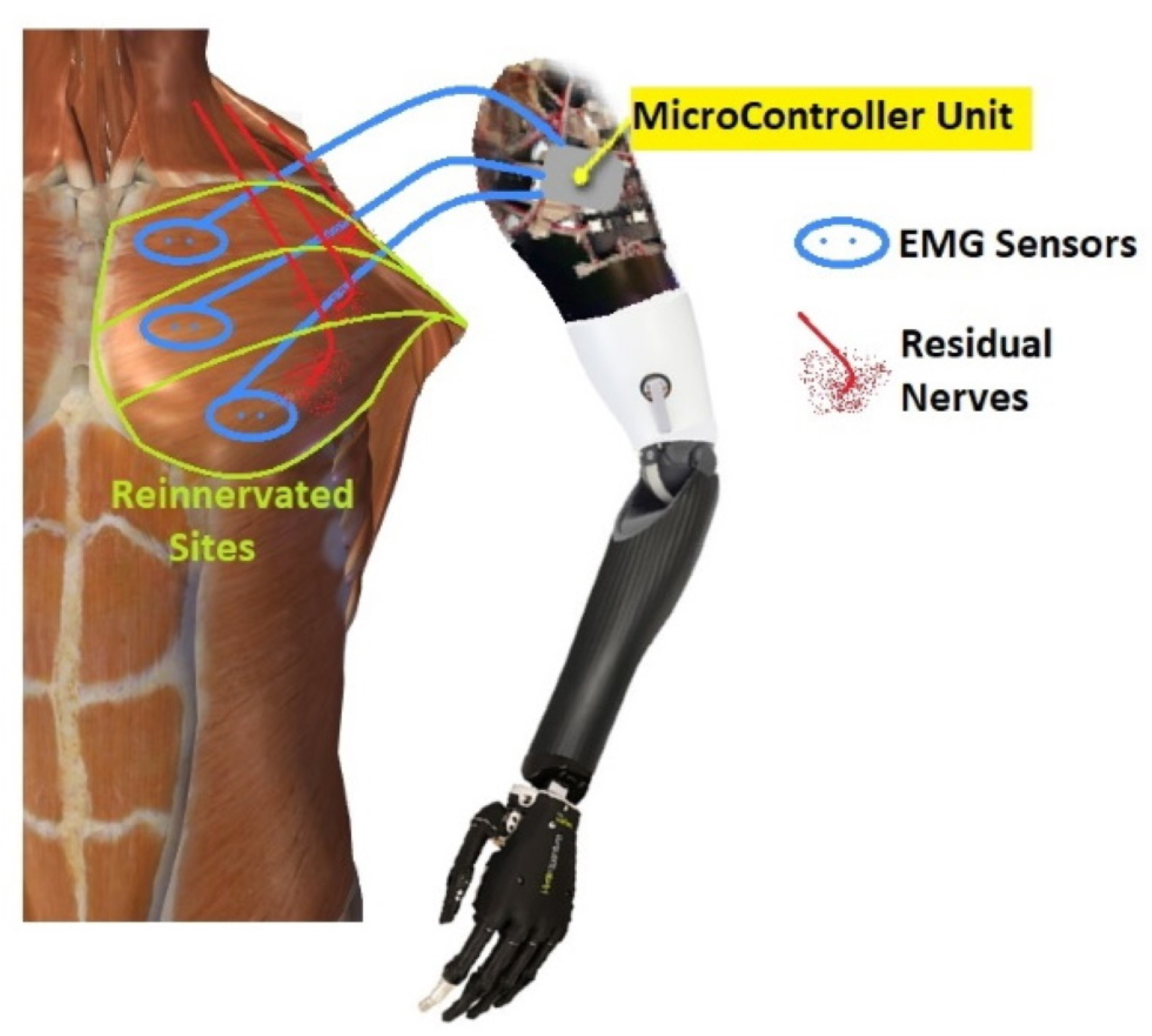Sensors 21 01953 g002 Sensors 21 01953 g002