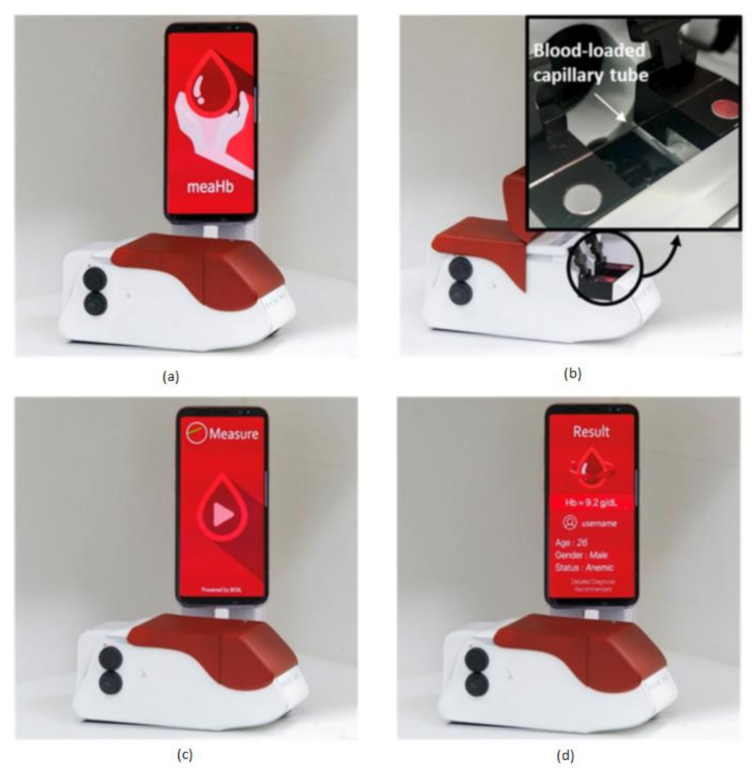 Sensors 21 02098 g014 Sensors 21 02098 g014