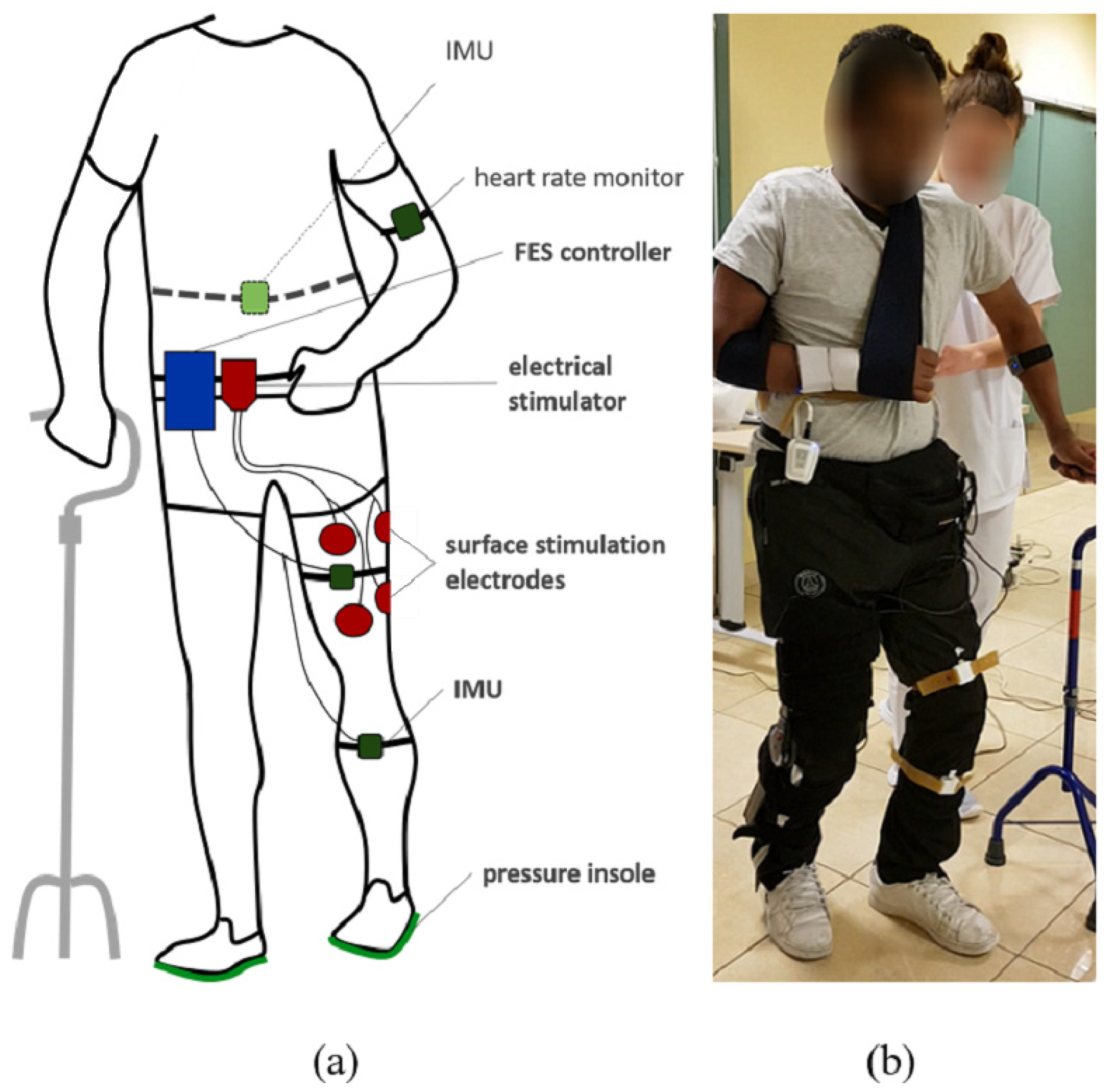 Sensors Free FullText A SensorBased Multichannel FES System to