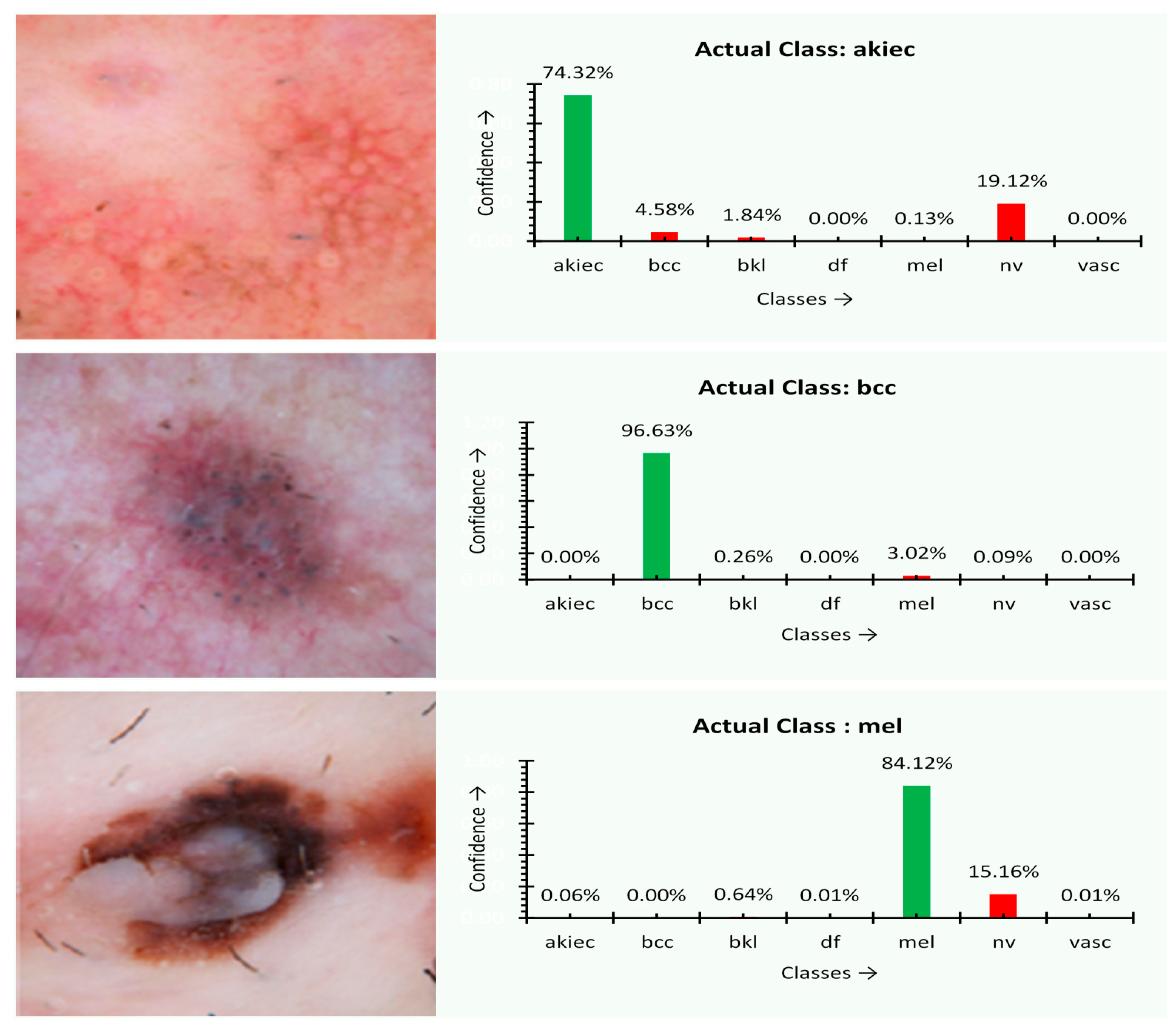 Sensors 21 02852 g005