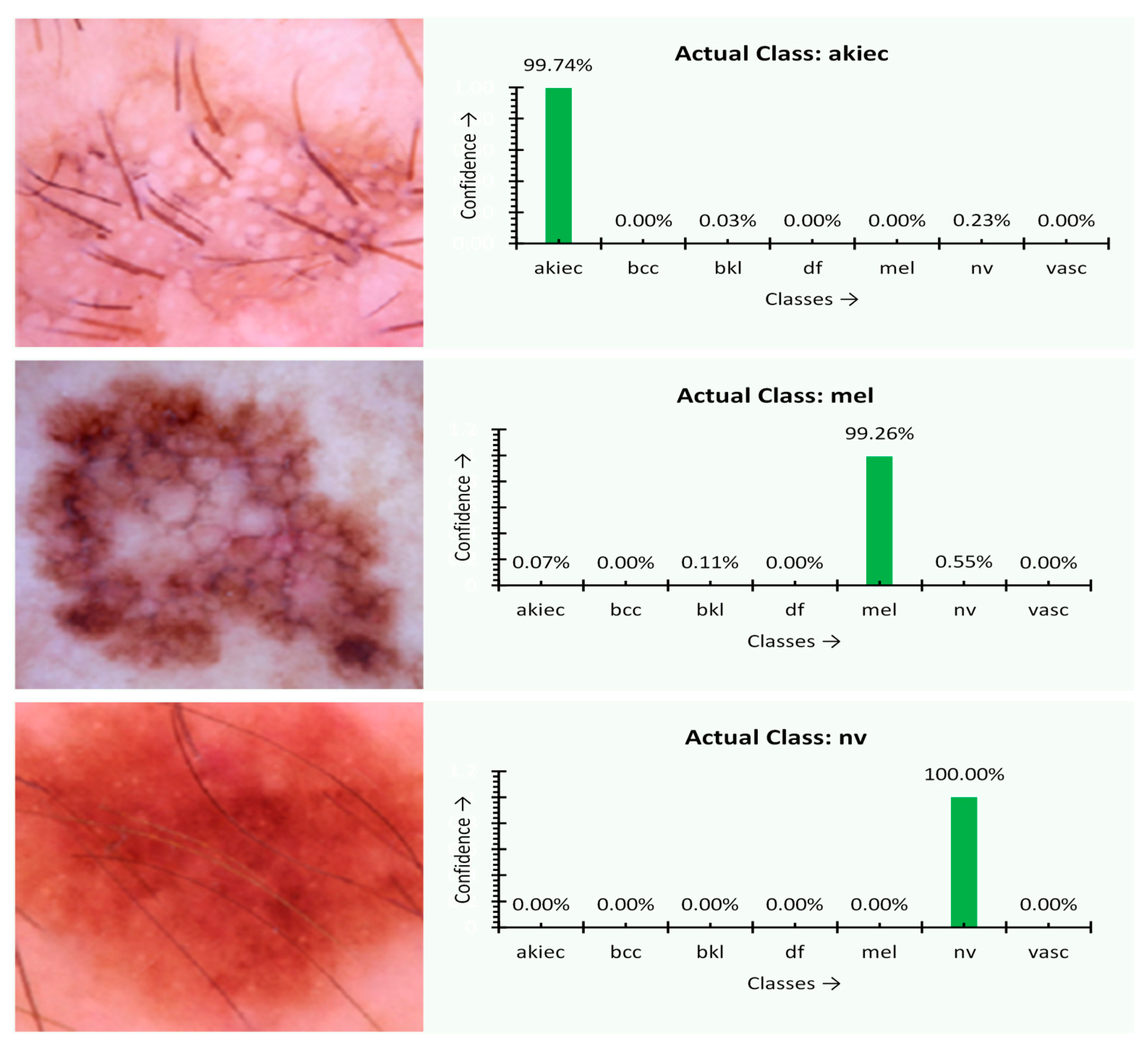 Sensors 21 02852 g007
