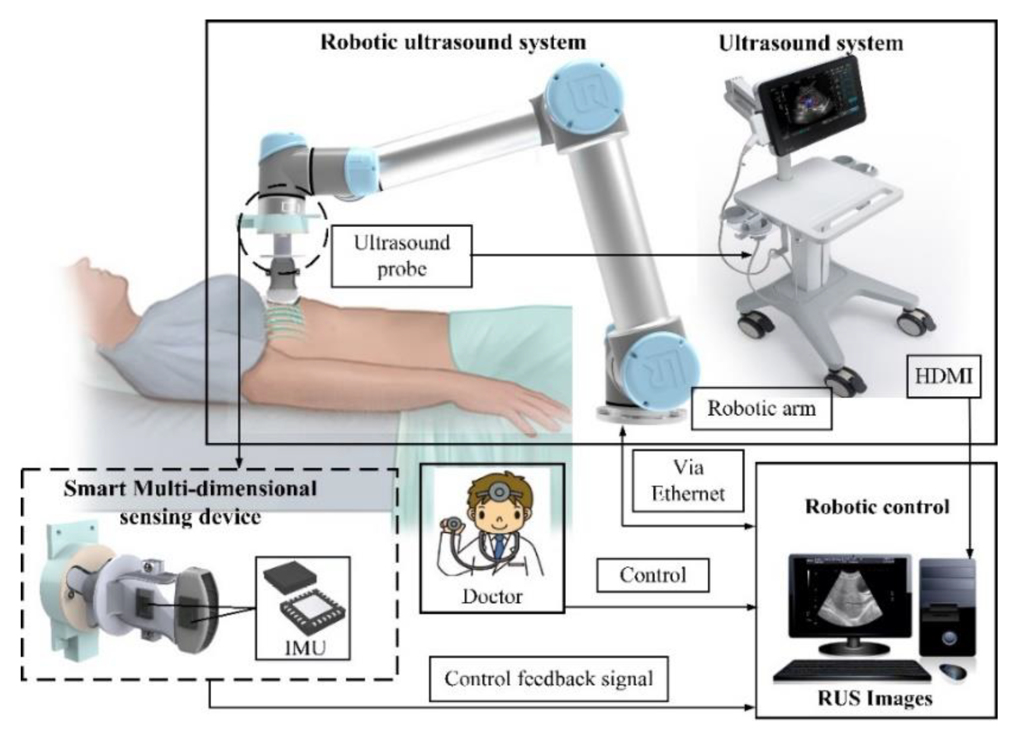 ultrasound machine diagram