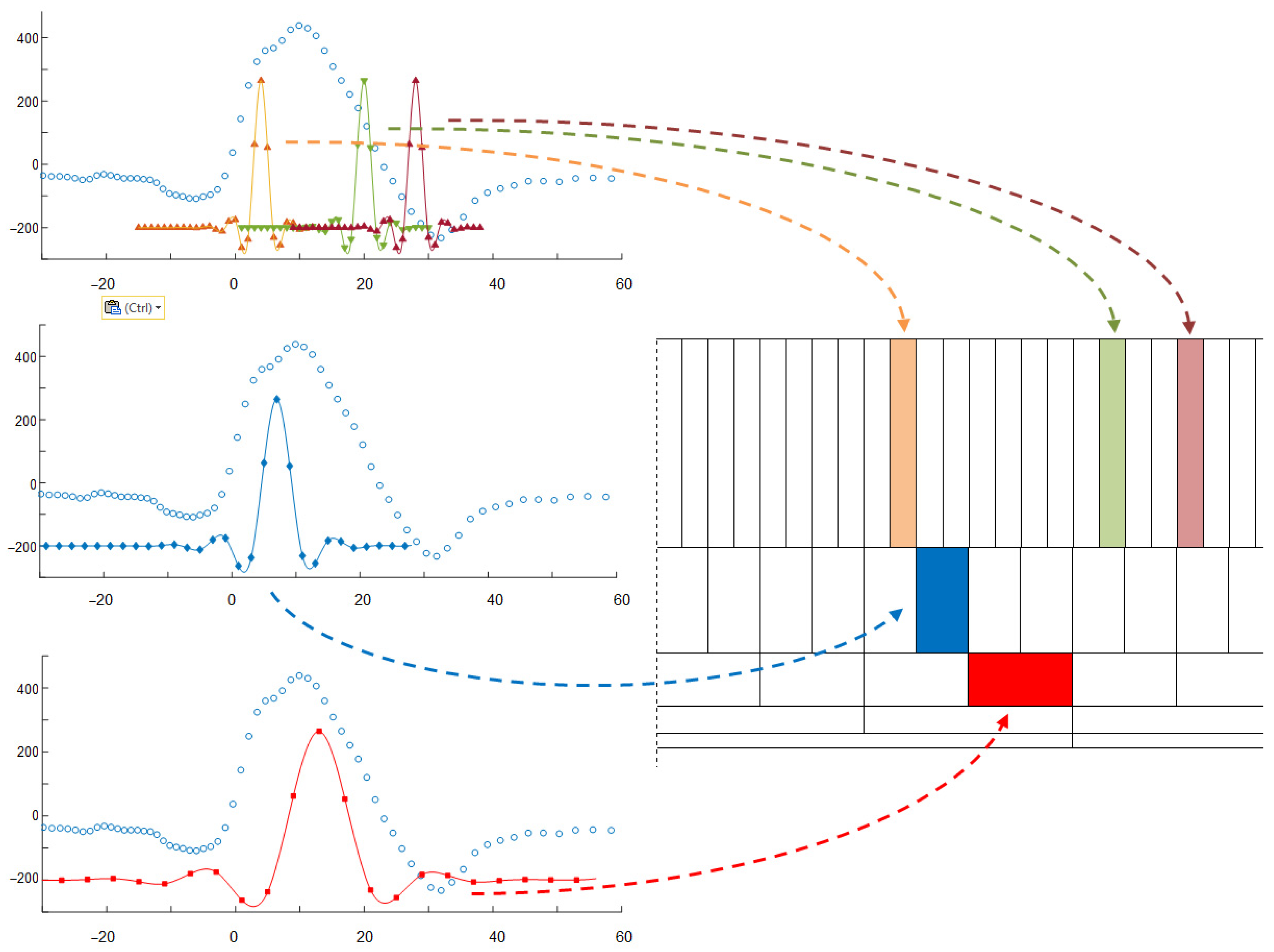 Sensors Free Full Text Diagnostic Interpretation Of Non Uniformly Sampled Electrocardiogram Html