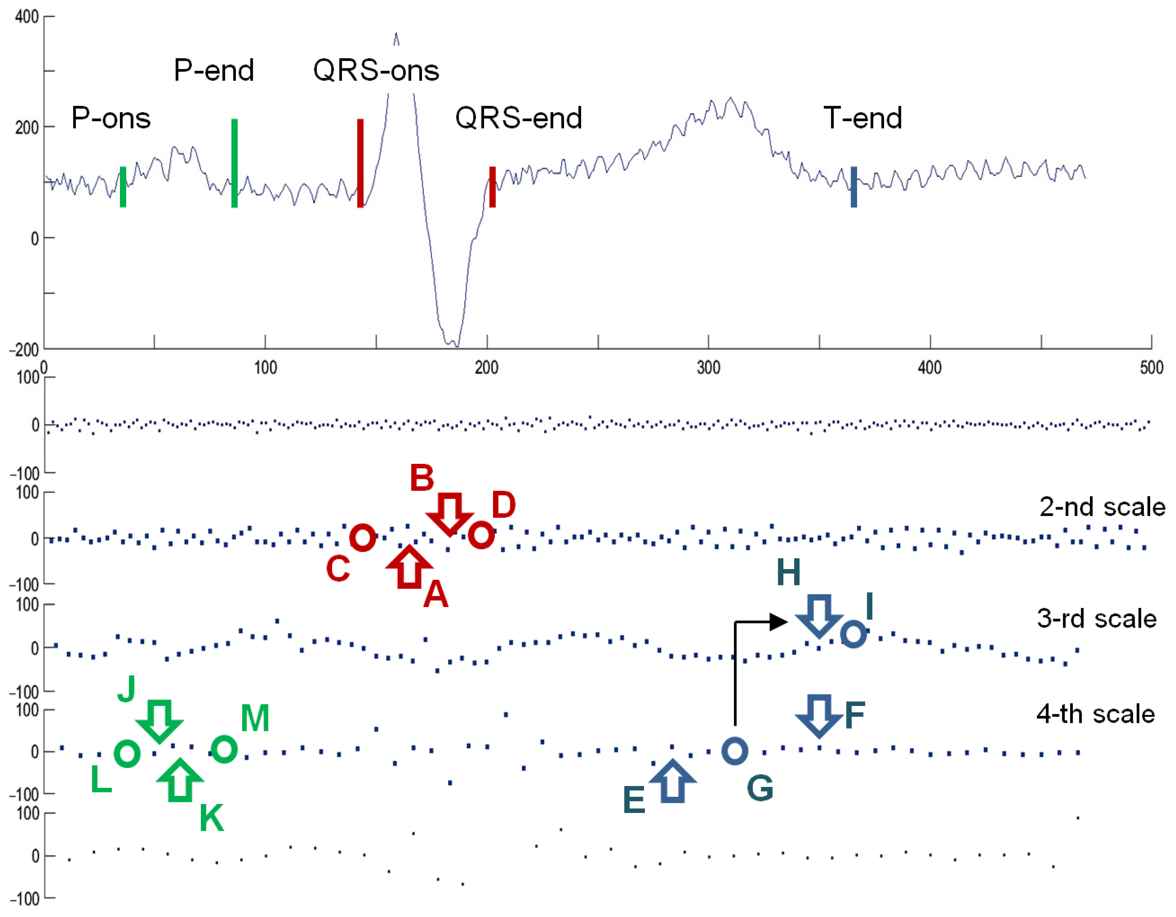 Sensors Free Full Text Diagnostic Interpretation Of Non Uniformly Sampled Electrocardiogram Html