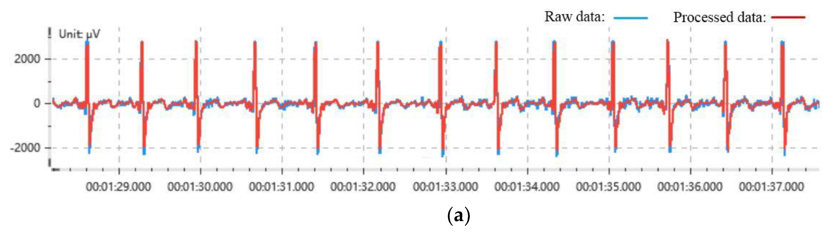 Sensors 21 03003 g002a Sensors 21 03003 g002a