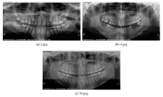 ー品販売  Panoramic Using Enhancement Image Radiography Dental 洋書