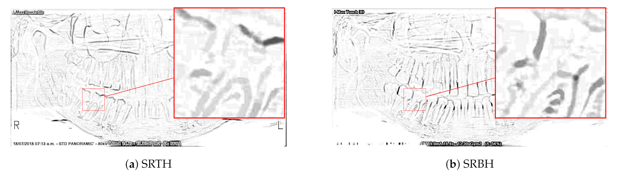 Sensors 21 03110 g002