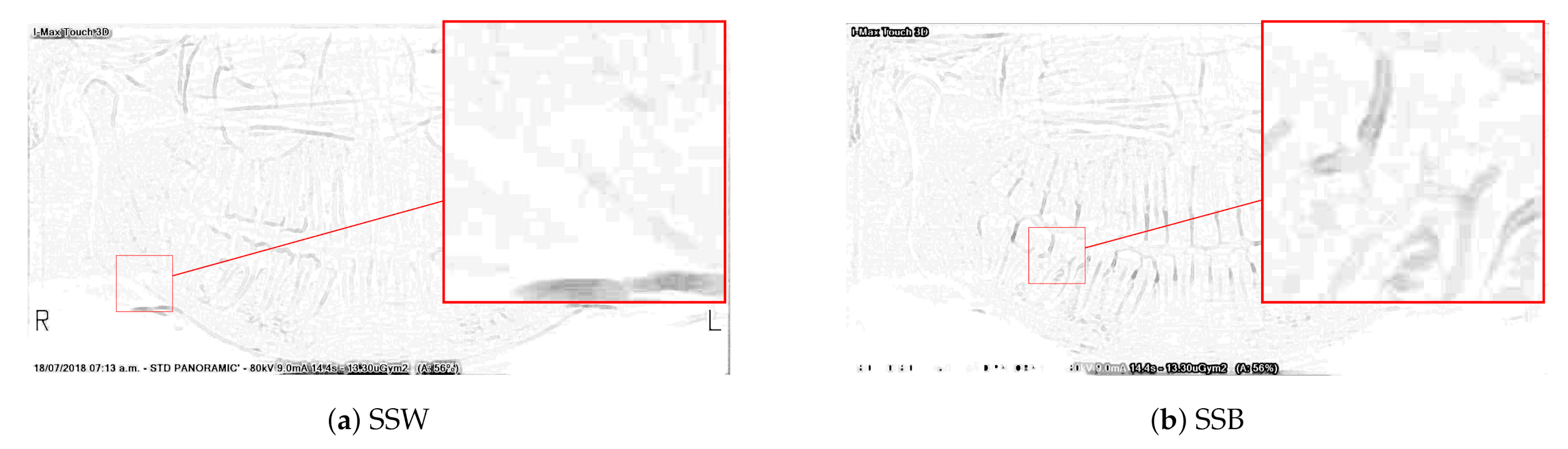 Sensors 21 03110 g003