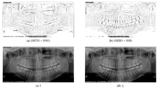 PANORAMIC RADIOLOGY SECOND EDITION 歯列矯正