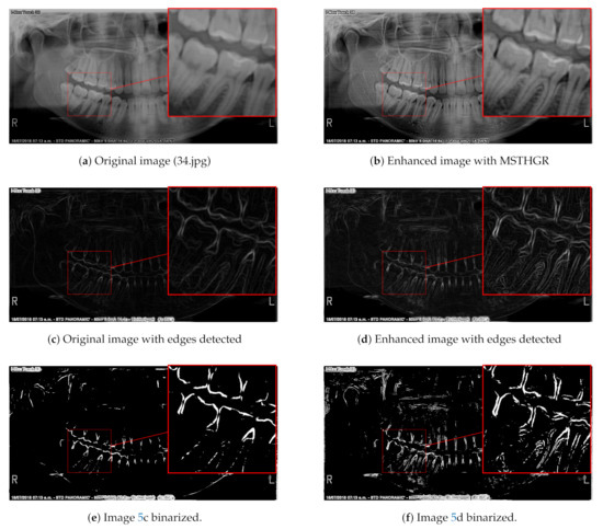 PANORAMIC RADIOLOGY SECOND EDITION　歯列矯正 PANORAMIC RADIOLOGY SECOND EDITION 歯列矯正