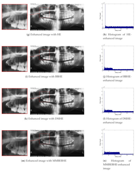 Panoramic Dental Radiography Image Enhancement Using
