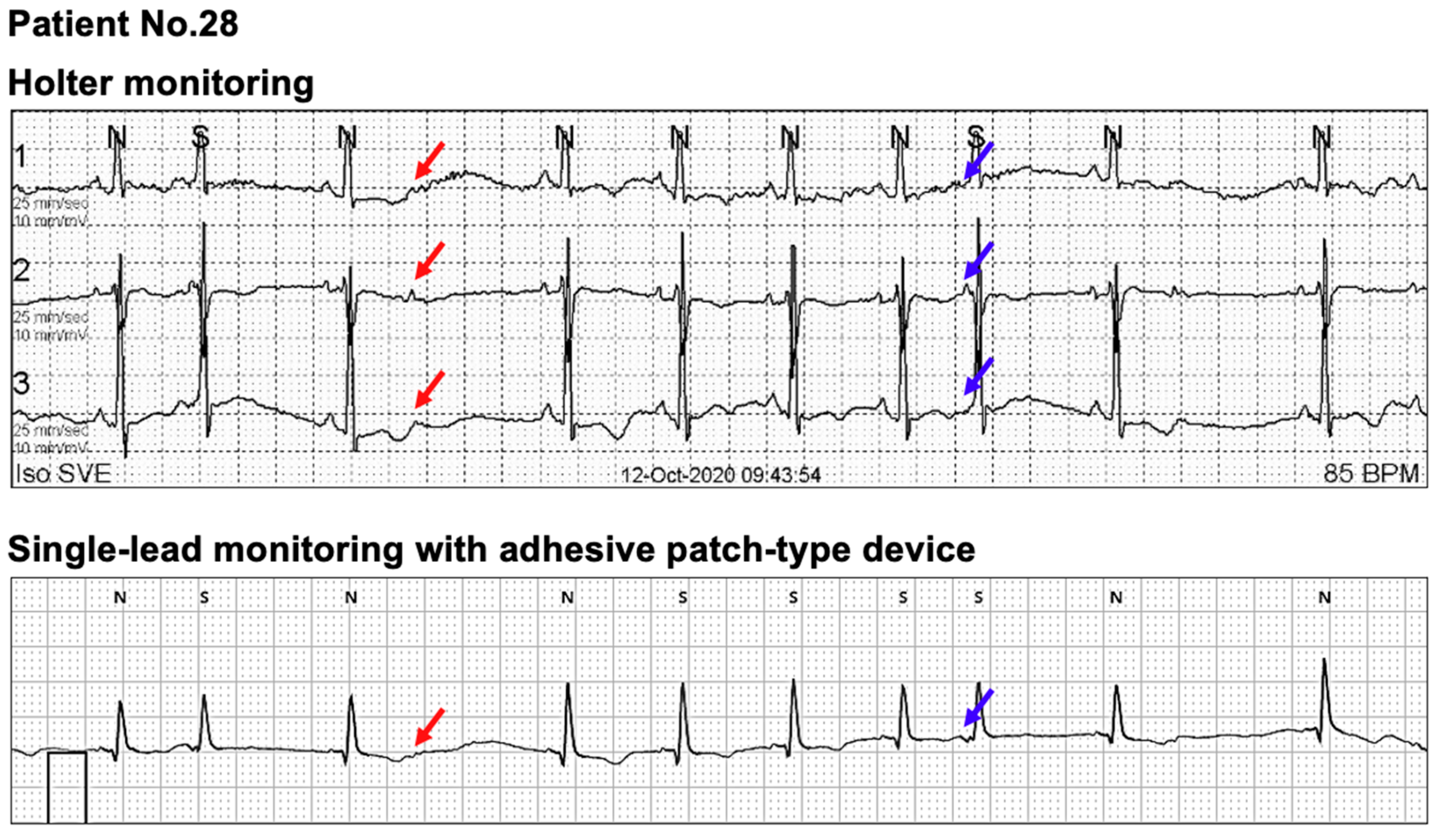 Sensors 21 03122 g005 Sensors 21 03122 g005
