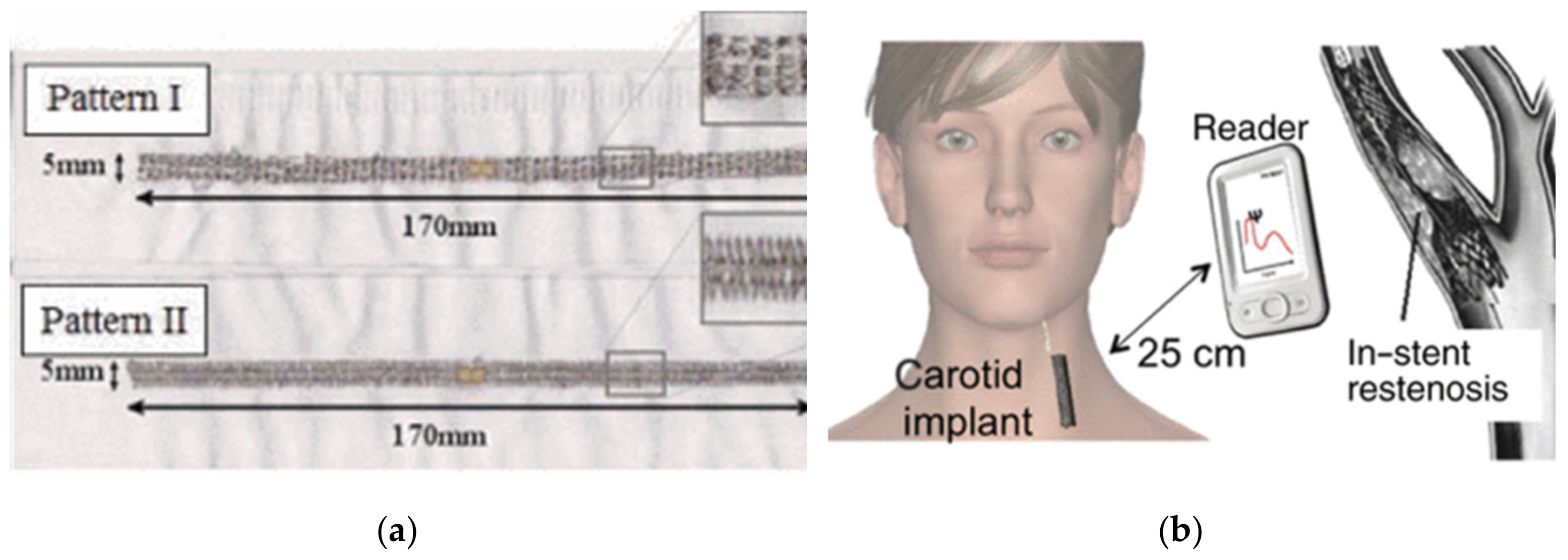 Sensors 21 03138 g016 550