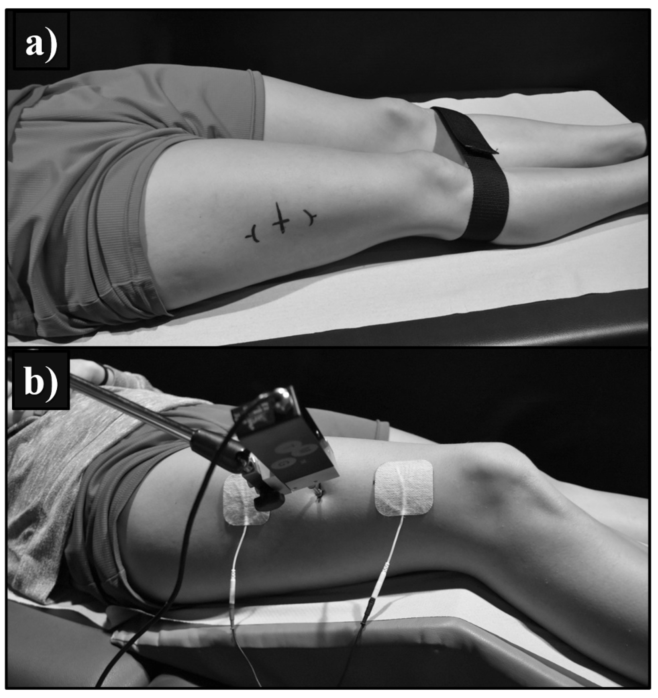 Sensors 21 03213 g001 Sensors 21 03213 g001