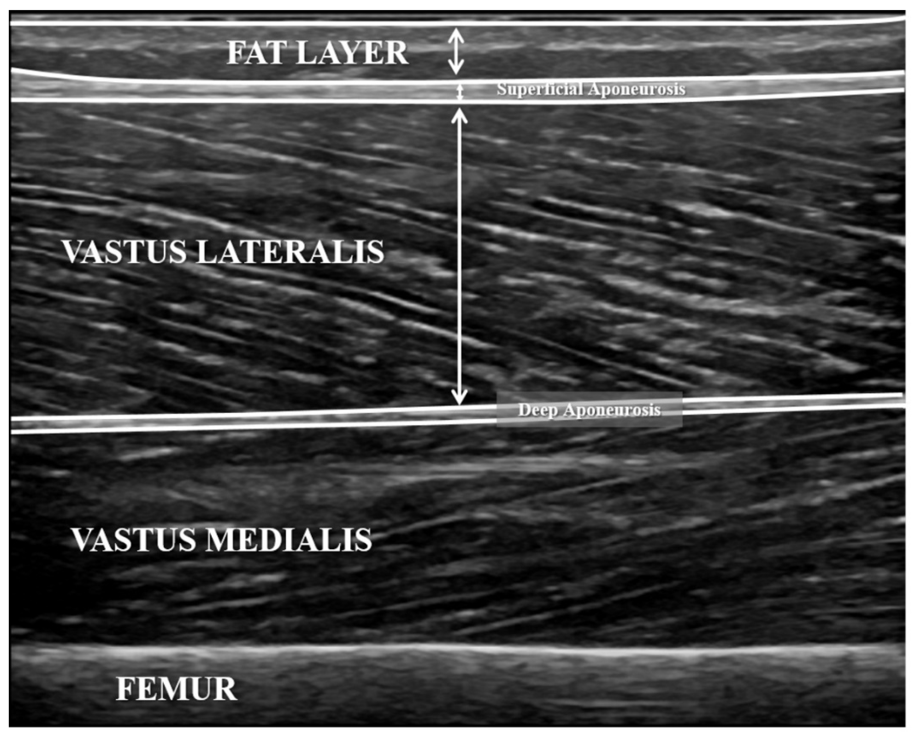 Sensors 21 03213 g002 Sensors 21 03213 g002