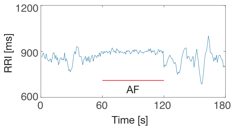 Sensors 21 03235 g013 Sensors 21 03235 g013
