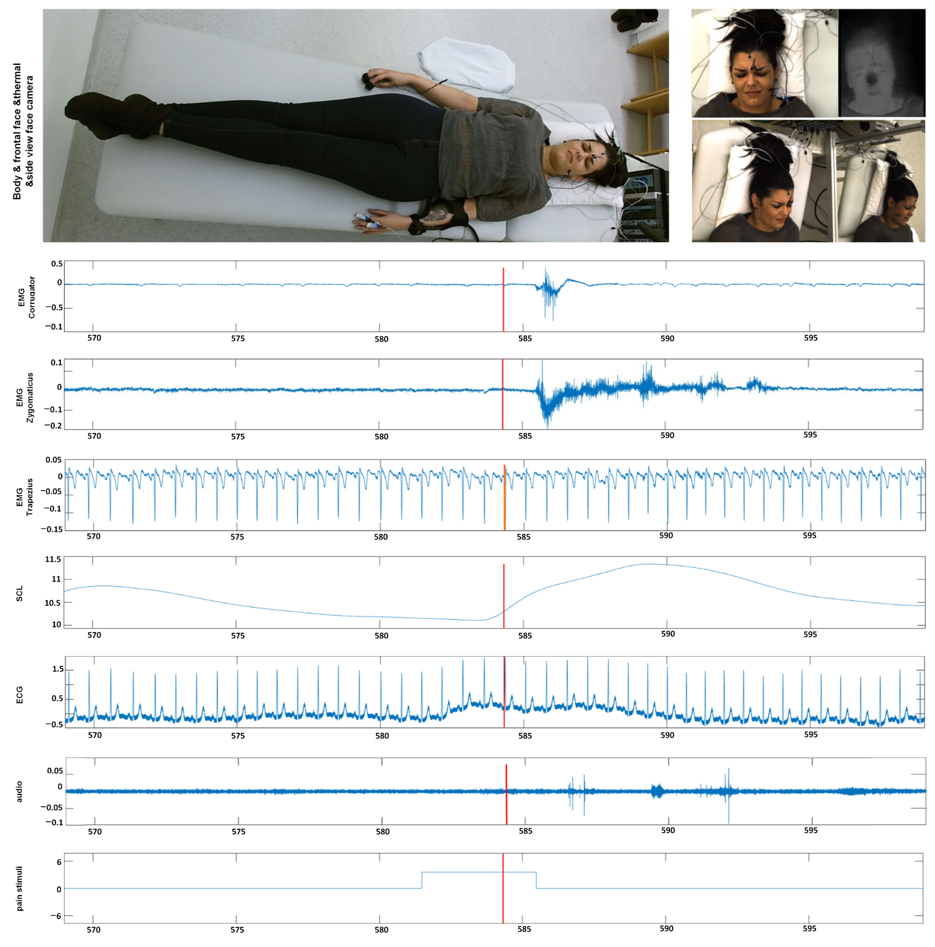 Sensors 21 03273 g002 Sensors 21 03273 g002