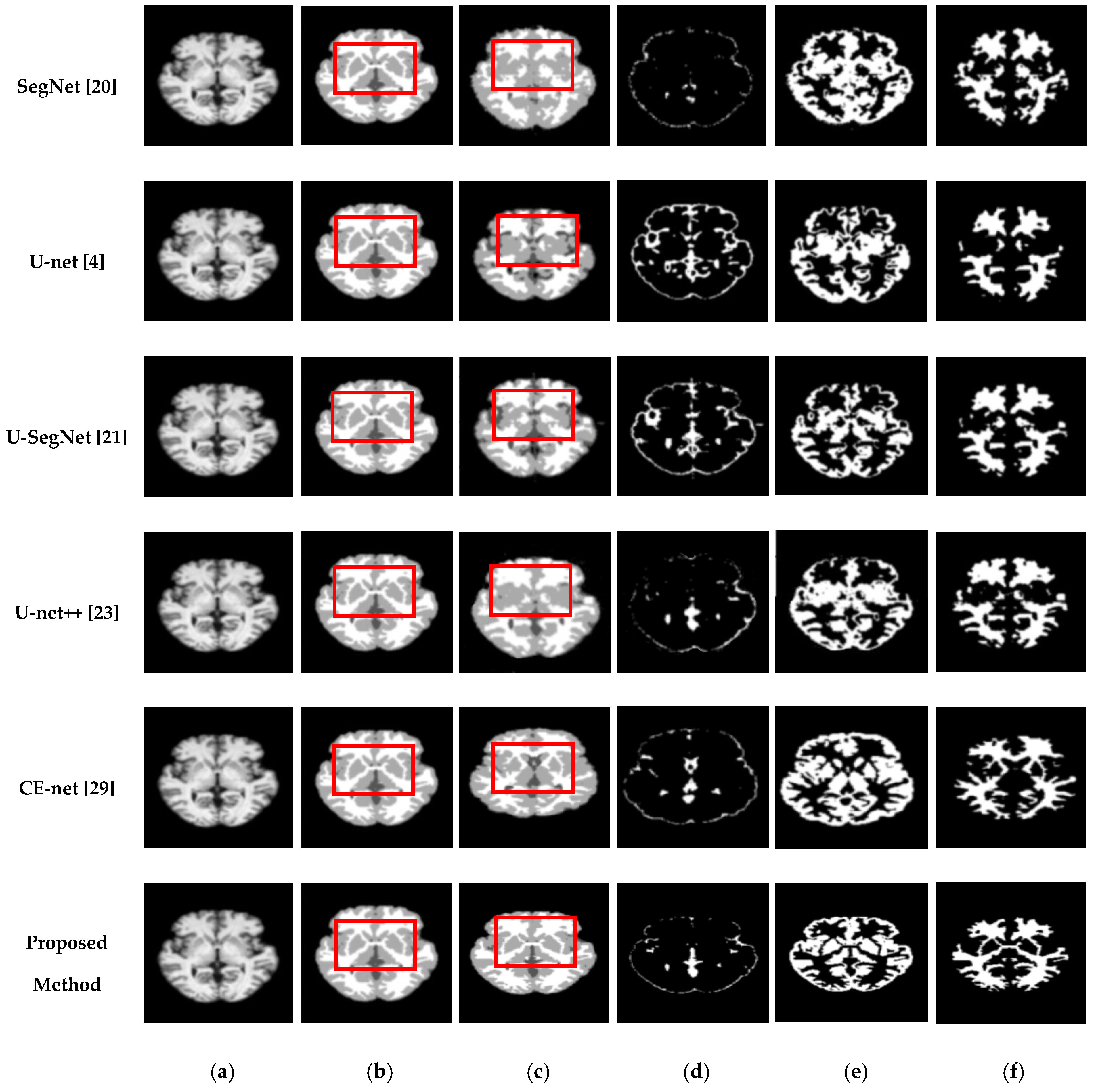 Sensors Free Full Text Multi Scale Squeeze U Segnet With Multi Global Attention For Brain Mri Segmentation Html Sensors Free Full Text Multi Scale Squeeze U Segnet With Multi Global Attention For Brain Mri Segmentation Html