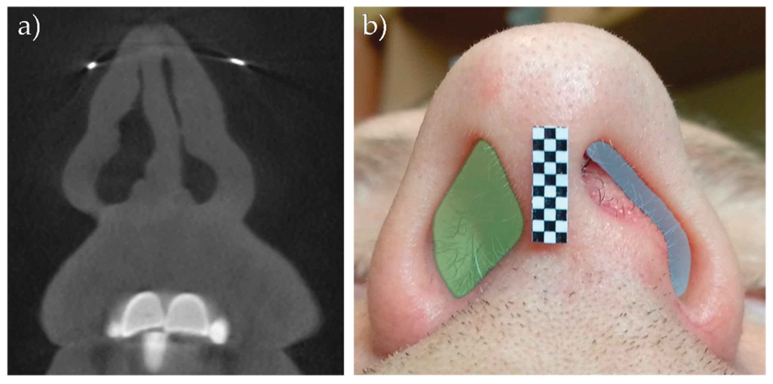 Sensors 21 03479 g017