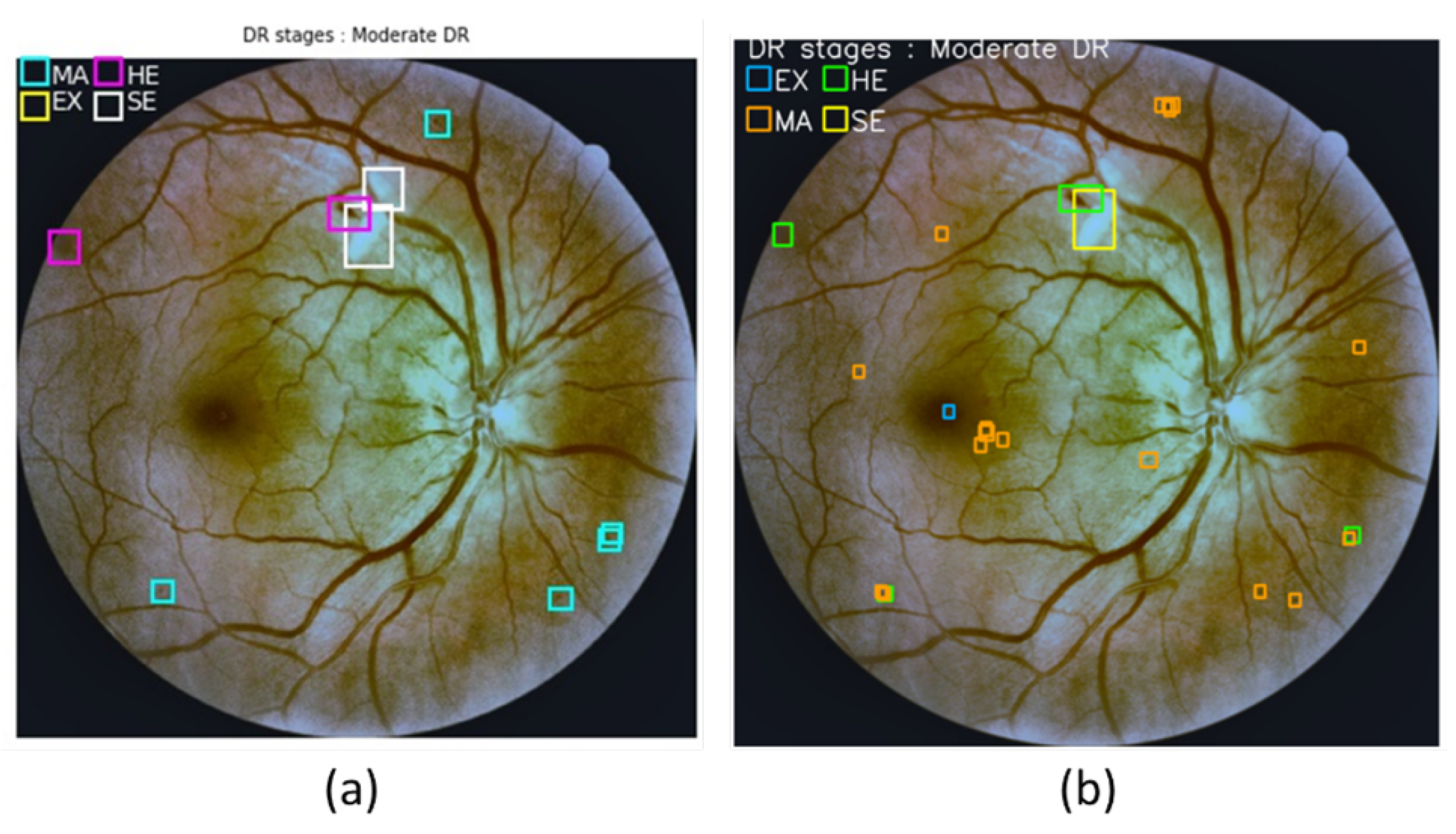 Sensors 21 03704 g013