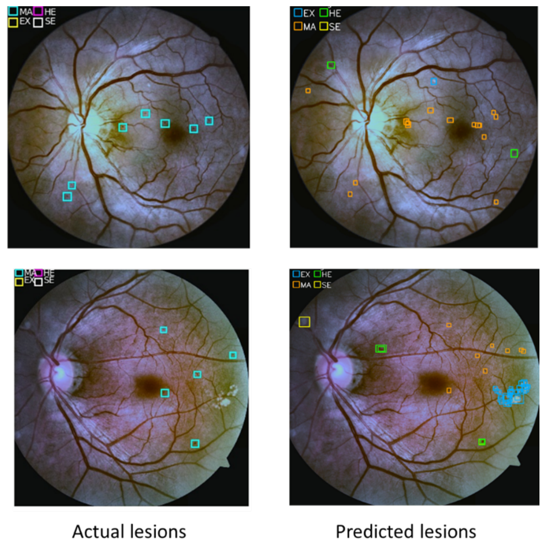 Sensors 21 03704 g015