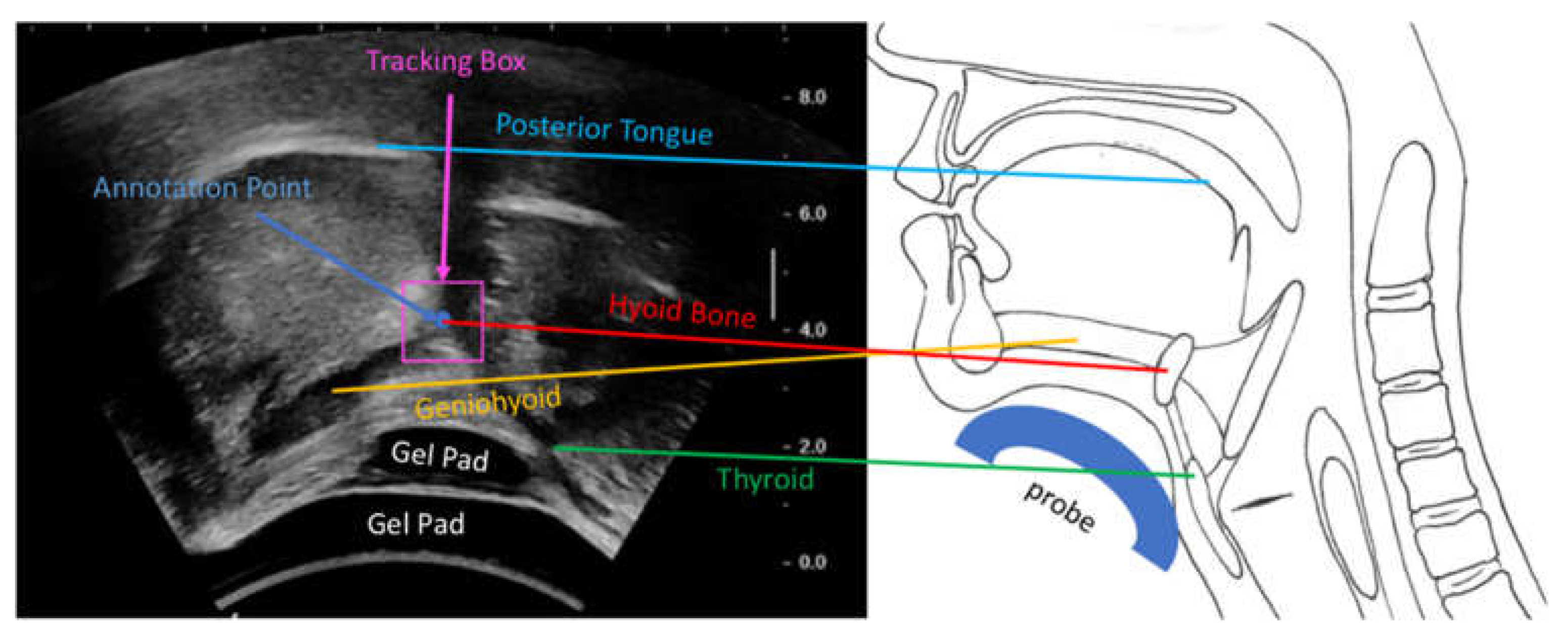 Sensors Free Full Text Automatic Hyoid Bone Tracking In Real Time Ultrasound Swallowing Videos Using Deep Learning Based And Correlation Filter Based Trackers Html