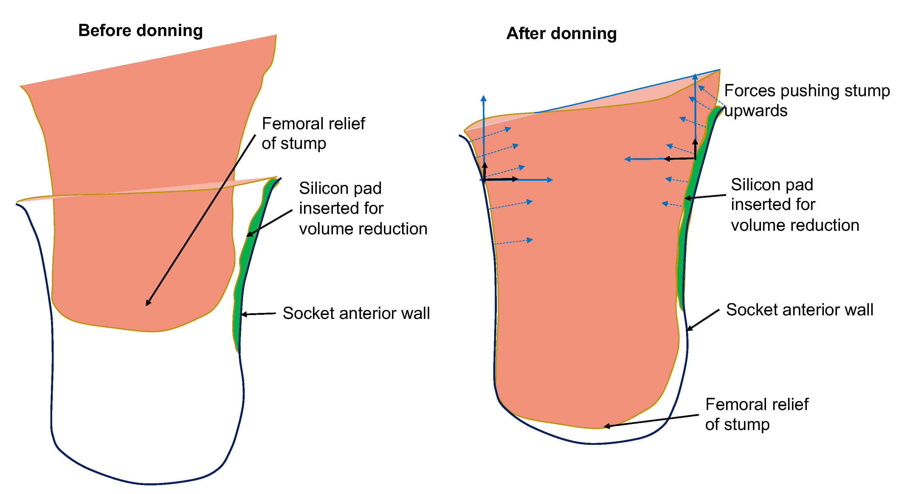 Sensors 21 03743 g006