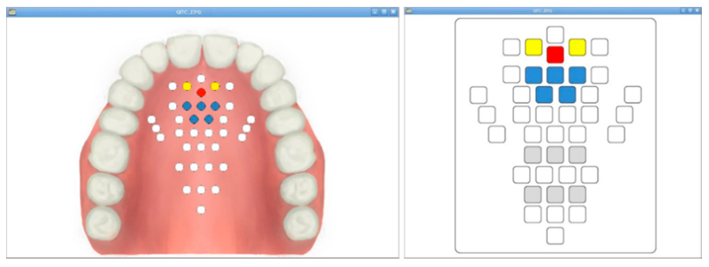 Sensors 21 03802 g005