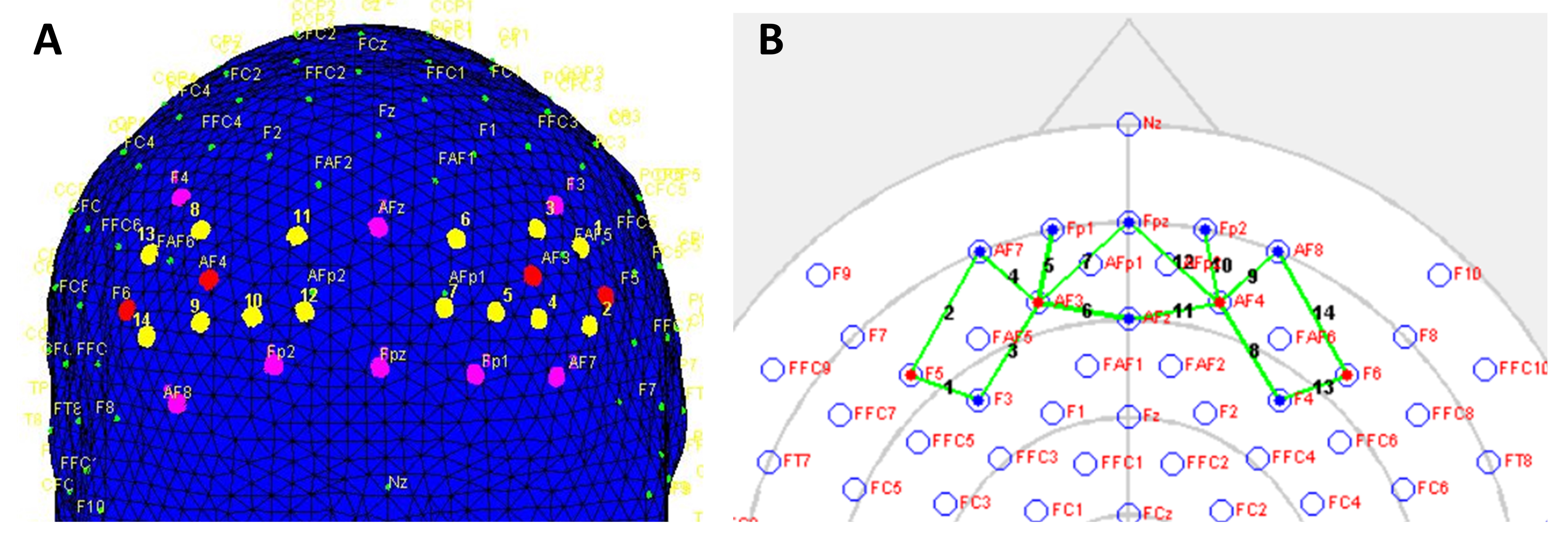 Sensors 21 03810 g003