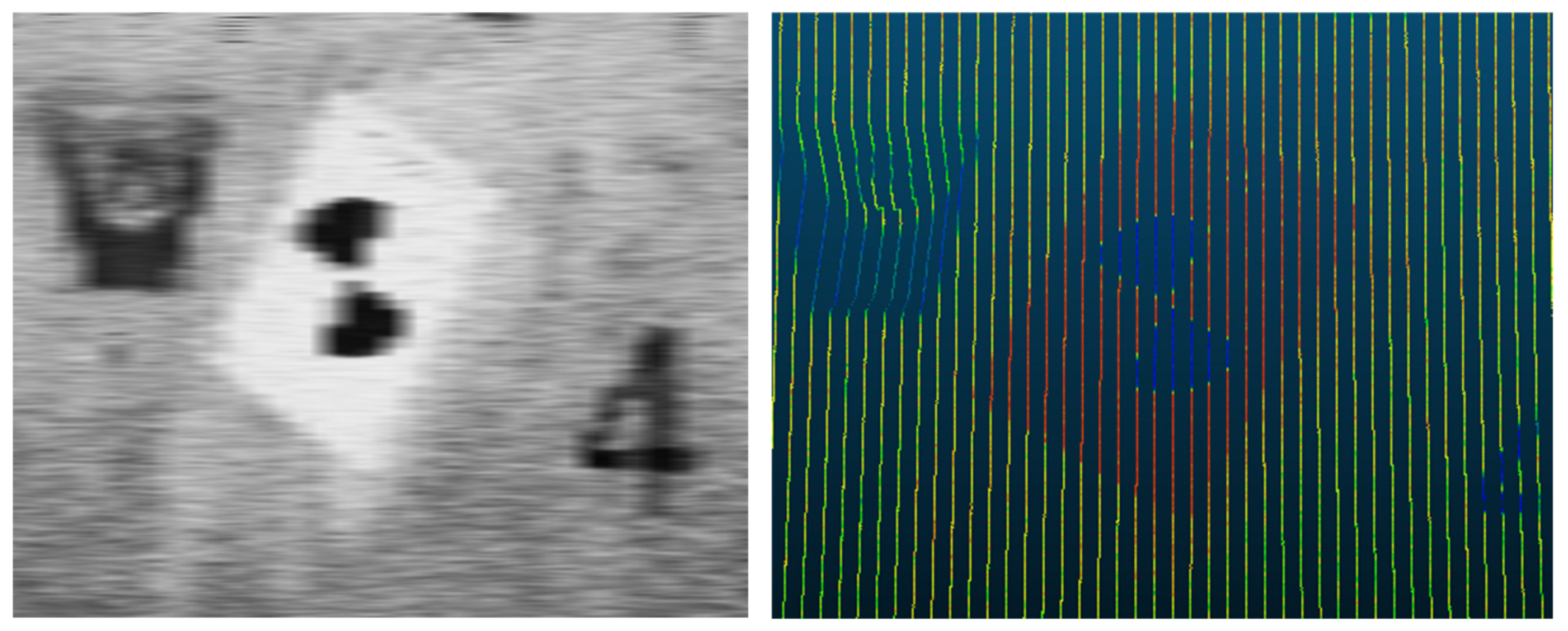 Sensors 21 03815 g013